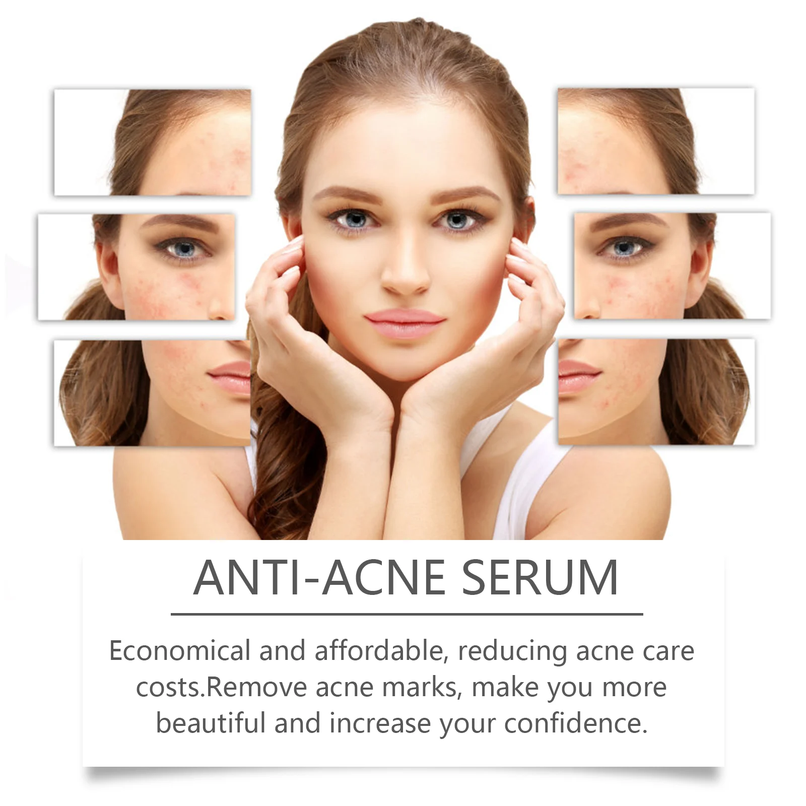 Niacinamide Anti-Acne Serum 50ml for Acne Scar Repair and Brightening 8 niacinamide anti acne serum 50ml cih 9agp5wbz desc 8