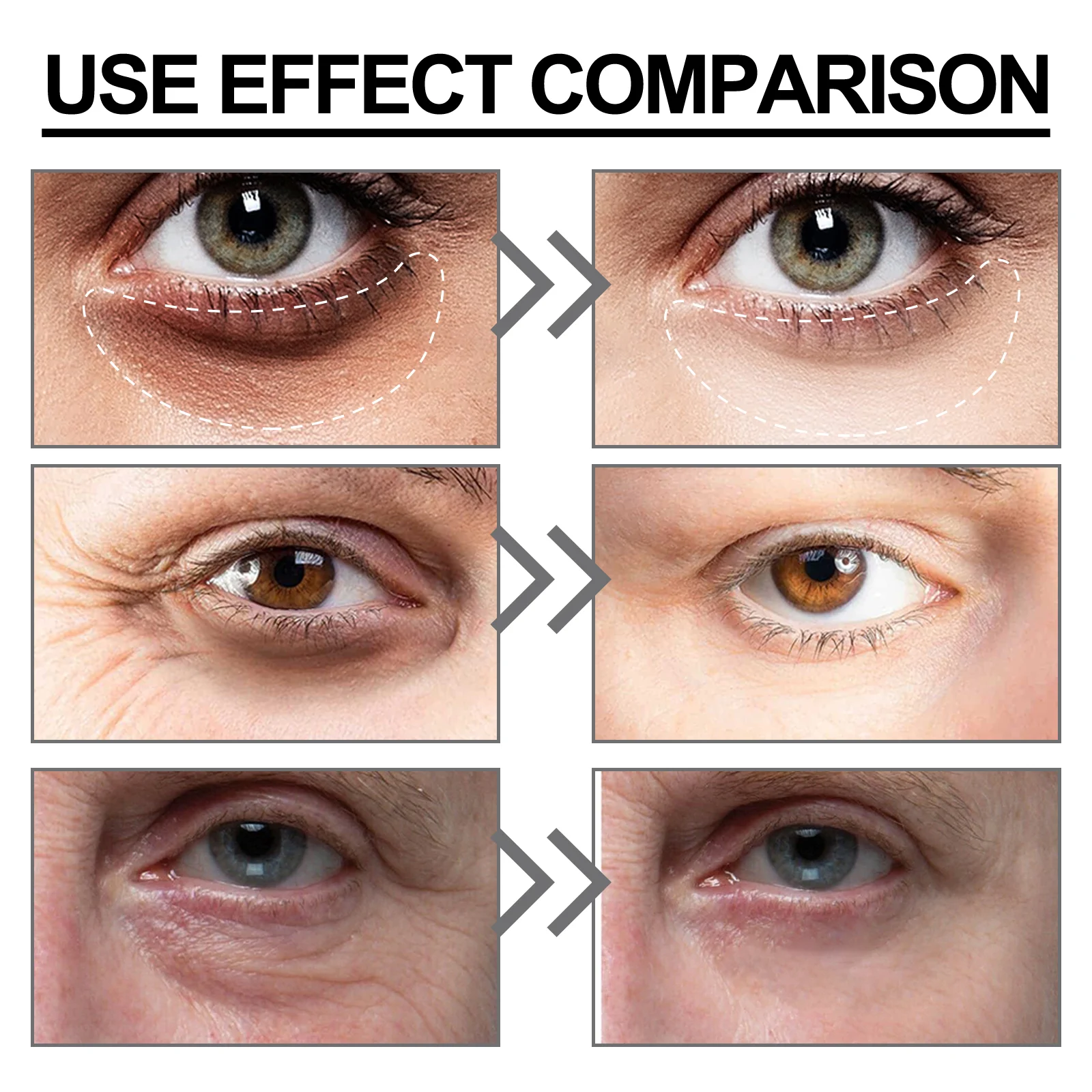 Nicotinamide Eye Cream 15ml Deeply Moisturizes & Reduces Dark Circles, Puffiness, Fine Lines, Wrinkles 8 nicotinamide eye cream 15ml cih dcpazvkn desc 8