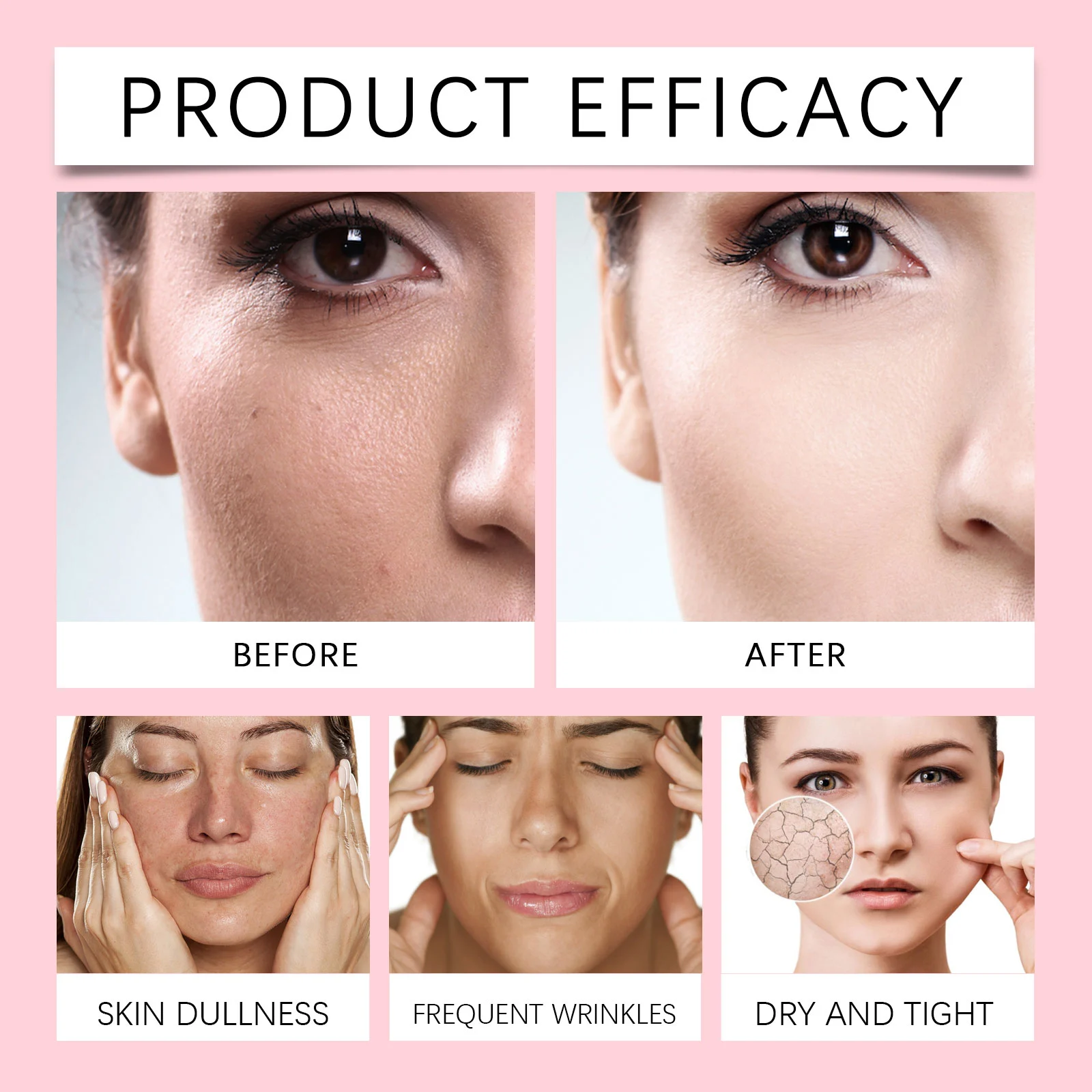 Nourishing Face Cream Hydrating Anti-Wrinkle Moisturizer with Hyaluronic Acid & Shea Butter 100ml 9 nourishing face cream hyaluronic acid shea butter 100ml cih vp4d86gz desc 9