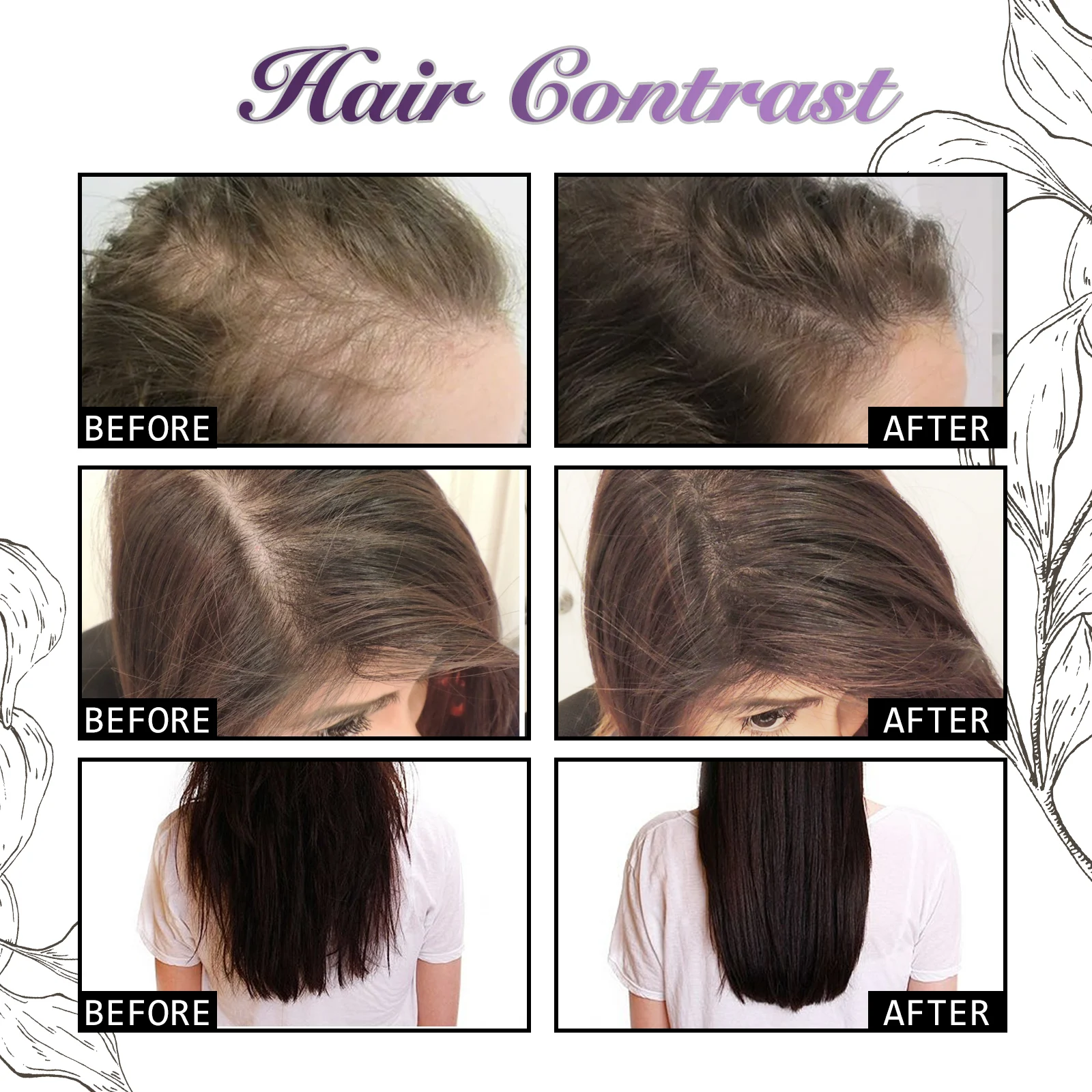 Onion Rosemary Hair Growth Spray Deep Nourishes Scalp Smooths & Strengthens Hair 30ml 8 onion rosemary hair growth spray 30ml cih xj8m8n3s desc 8