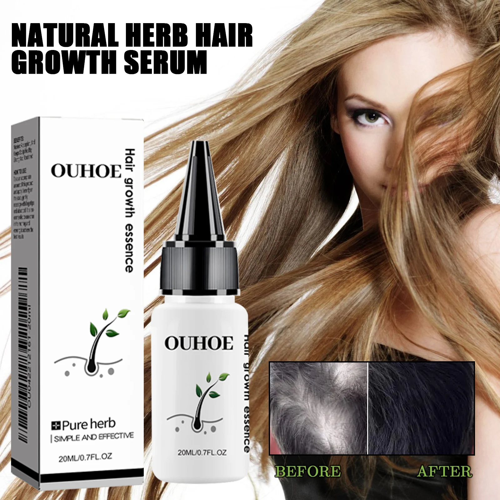 Herbal Hair Growth Serum 20ml for Thicker Stronger Hair with Ginseng & He Shou Wu 1 ouhoe herbal hair growth serum 20ml cih te5g74ya desc 1