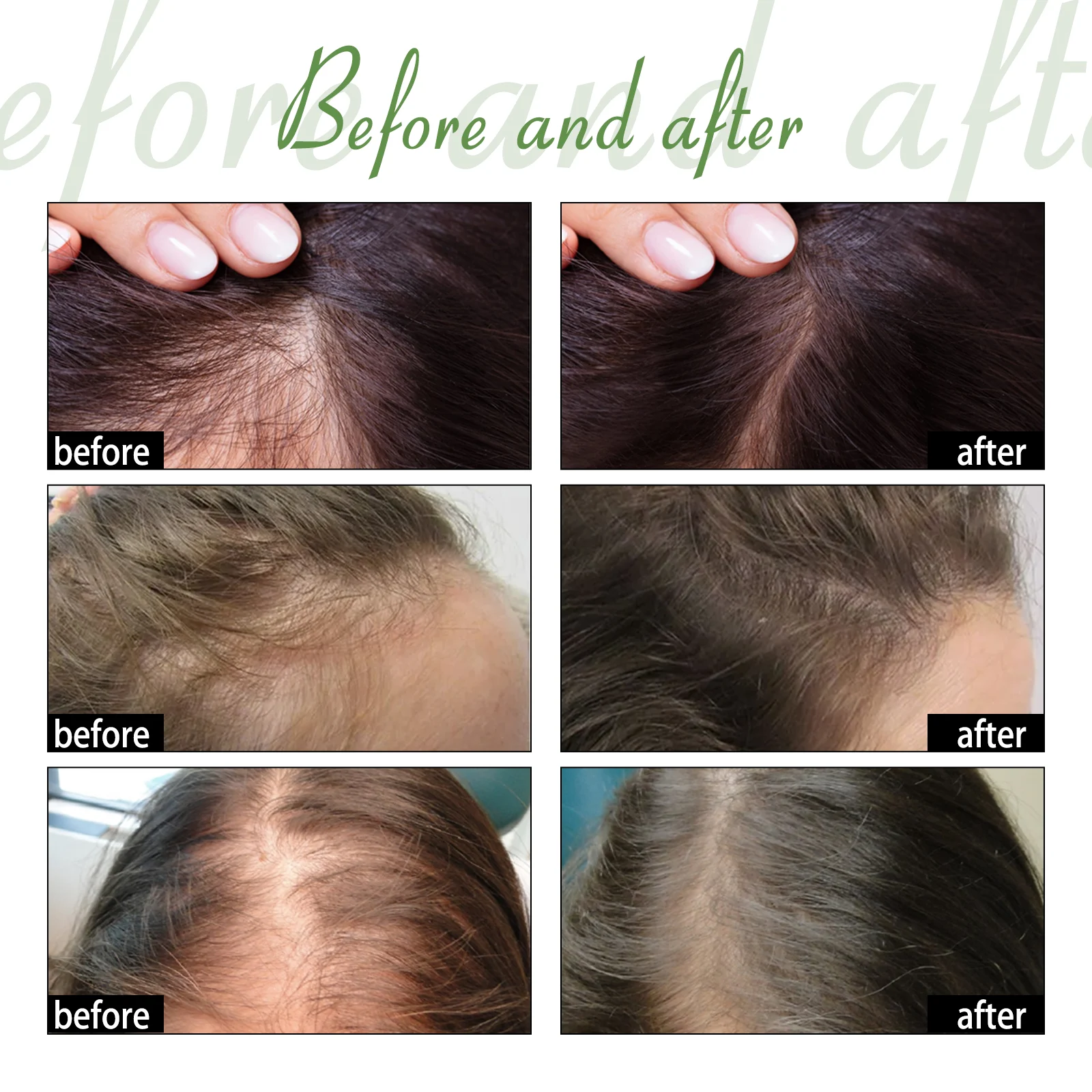 Herbal Hair Growth Serum 20ml for Thicker Stronger Hair with Ginseng & He Shou Wu 8 ouhoe herbal hair growth serum 20ml cih te5g74ya desc 8