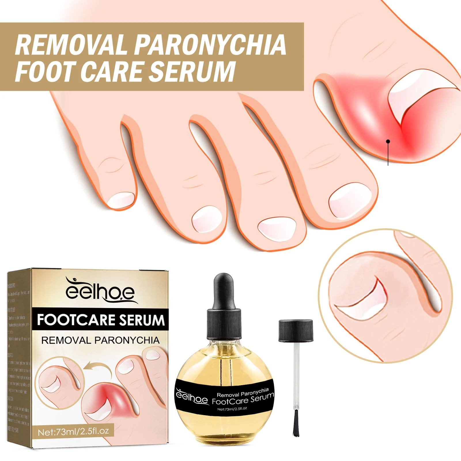 Paronychia Treatment Serum for Ingrown Toenails, Thickened & Fungal Nails - 73ml with Brush 1 paronychia treatment serum ingrown toenail fungal nail repair 73ml cih 462q693r desc 1