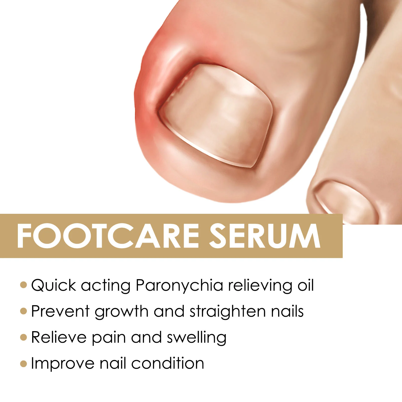 Paronychia Treatment Serum for Ingrown Toenails, Thickened & Fungal Nails - 73ml with Brush 4 paronychia treatment serum ingrown toenail fungal nail repair 73ml cih 462q693r desc 4