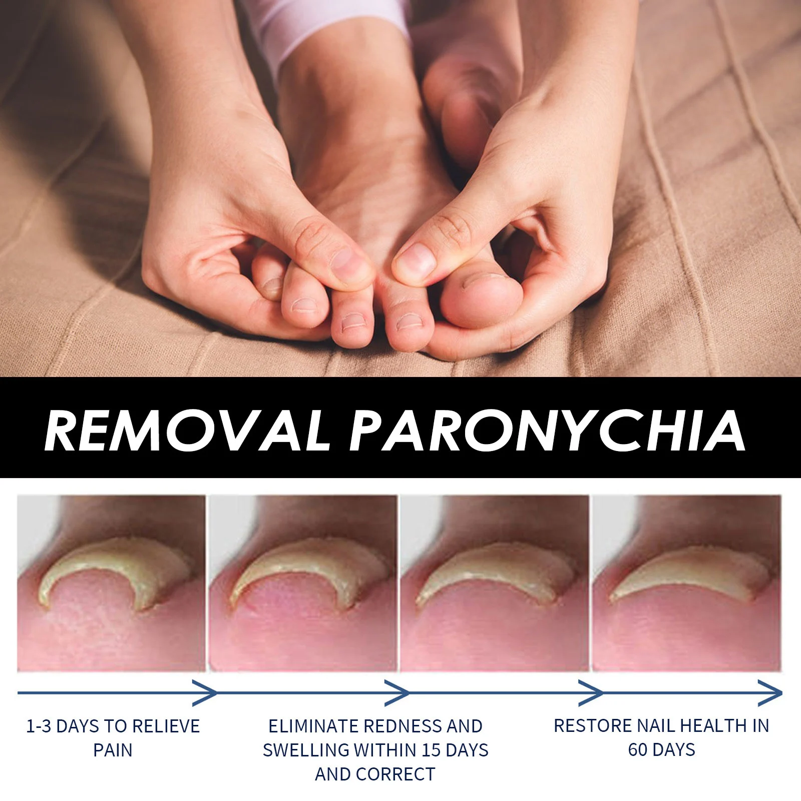 Paronychia Treatment Serum for Ingrown Toenails, Thickened & Fungal Nails - 73ml with Brush 6 paronychia treatment serum ingrown toenail fungal nail repair 73ml cih 462q693r desc 6