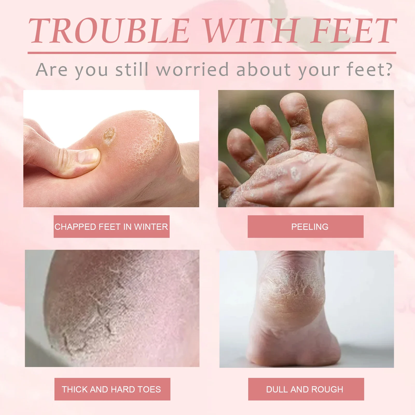 Peach Foot Peel Mask Moisturizing Exfoliating Callus Remover for Dry Cracked Heels 5 peach foot peel mask exfoliating callus remover cih y6z6h8kn desc 5