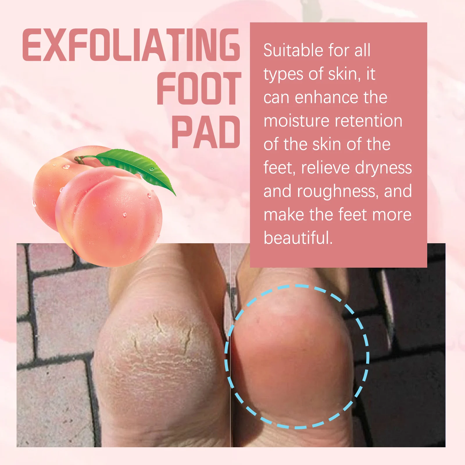 Peach Foot Peel Mask Moisturizing Exfoliating Callus Remover for Dry Cracked Heels 7 peach foot peel mask exfoliating callus remover cih y6z6h8kn desc 7