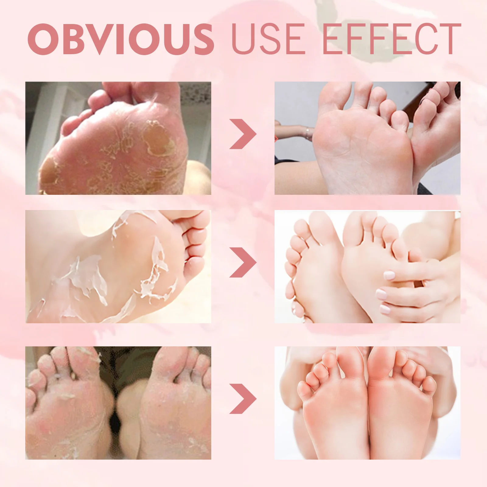 Peach Foot Peel Mask Moisturizing Exfoliating Callus Remover for Dry Cracked Heels 8 peach foot peel mask exfoliating callus remover cih y6z6h8kn desc 8