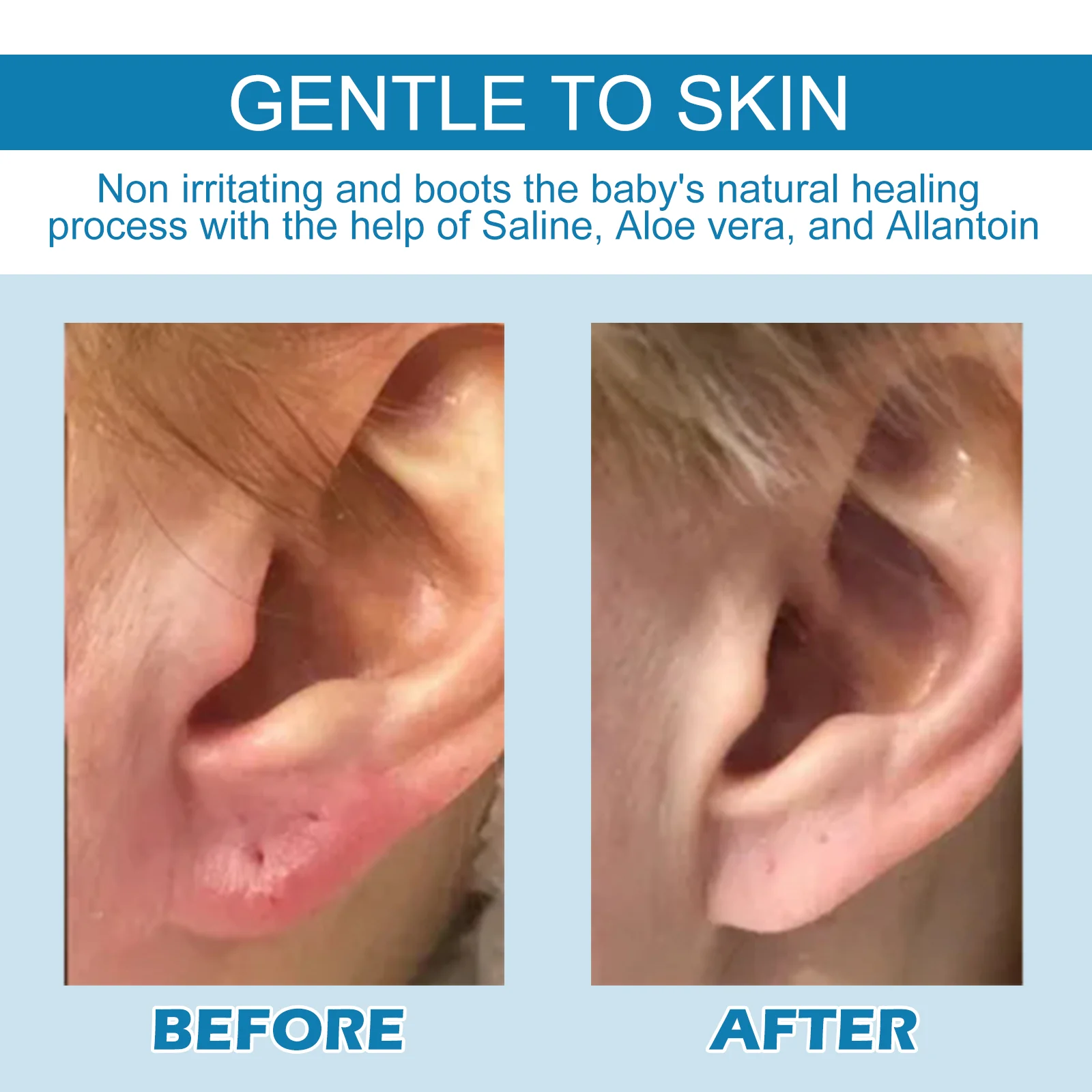 Piercing Aftercare Solution Drops for Keloids and Bumps with Saline and Aloe Vera 30ml 8 piercing aftercare solution drops keloids bumps 30ml cih q32fmaq2 desc 8