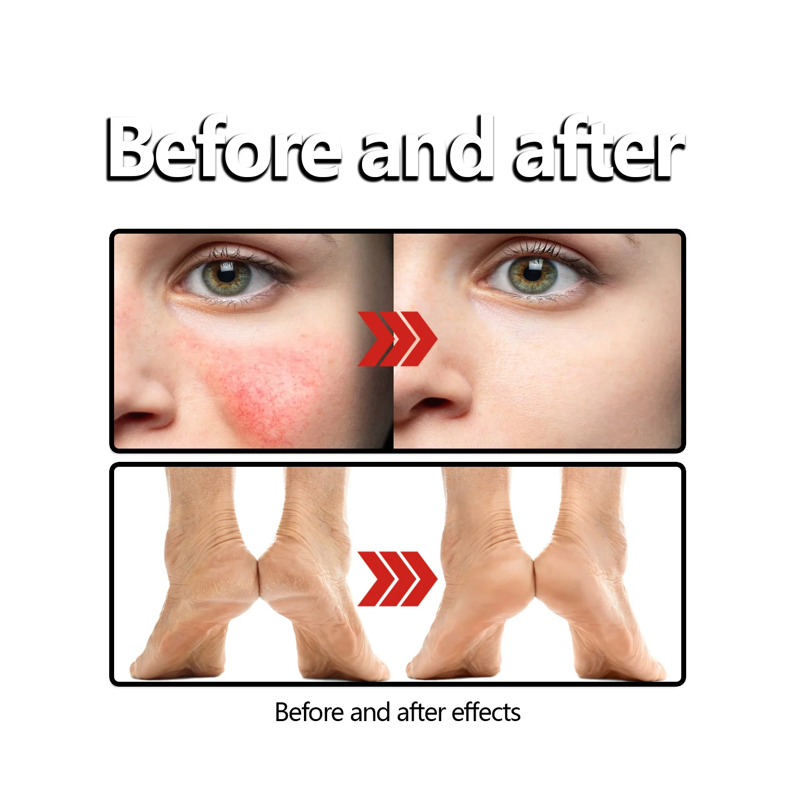 OUHOE Plum & Beeswax Skin Care Cream for Dry, Irritated Skin, Tattoo Aftercare & Insect Bites 9 plum beeswax skin care cream cih 8z7pvbz3 desc 9