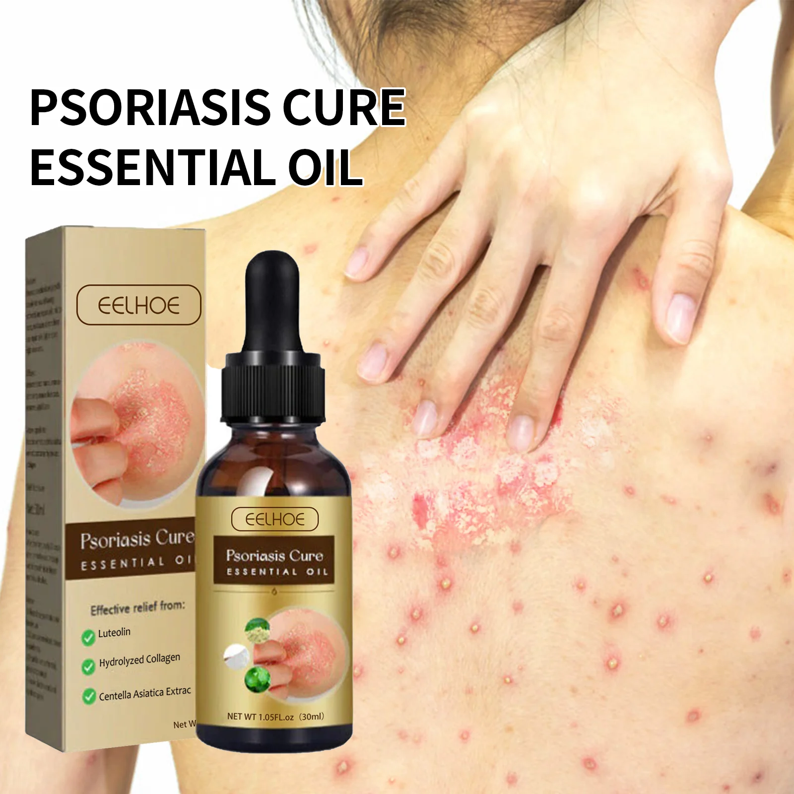 Psoriasis Relief & Skin Repair Essential Oil 30ml with Luteolin & Collagen 2 psoriasis relief skin repair essential oil 30ml cih 55g7sdv5 desc 2