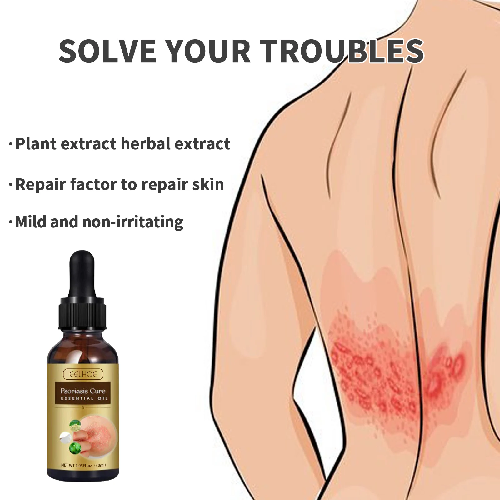 Psoriasis Relief & Skin Repair Essential Oil 30ml with Luteolin & Collagen 6 psoriasis relief skin repair essential oil 30ml cih 55g7sdv5 desc 6