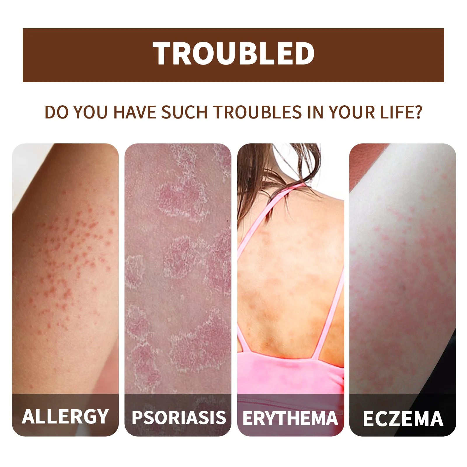 Psoriasis Relief & Skin Repair Essential Oil 30ml with Luteolin & Collagen 8 psoriasis relief skin repair essential oil 30ml cih 55g7sdv5 desc 9