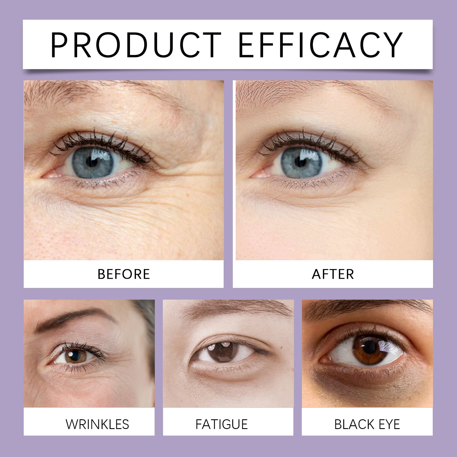 Hoygi Retinol Eye Cream for Dark Circles & Wrinkles, Moisturizing & Anti-Aging Eye Care 12 retinol eye cream der sqbpw9ta desc 12