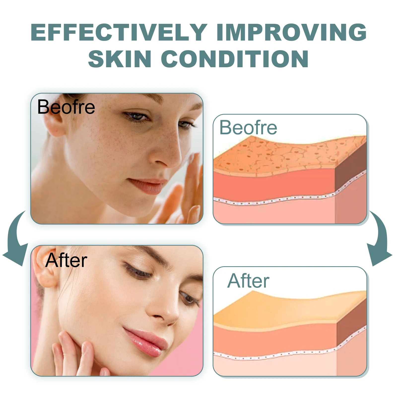 Retinol Serum 20ml for Wrinkles, Dark Spots & Dullness - Skin Brightening & Anti-Aging Treatment 10 retinol serum 20ml wrinkle dark spot treatment cih z9c785j9 desc 10