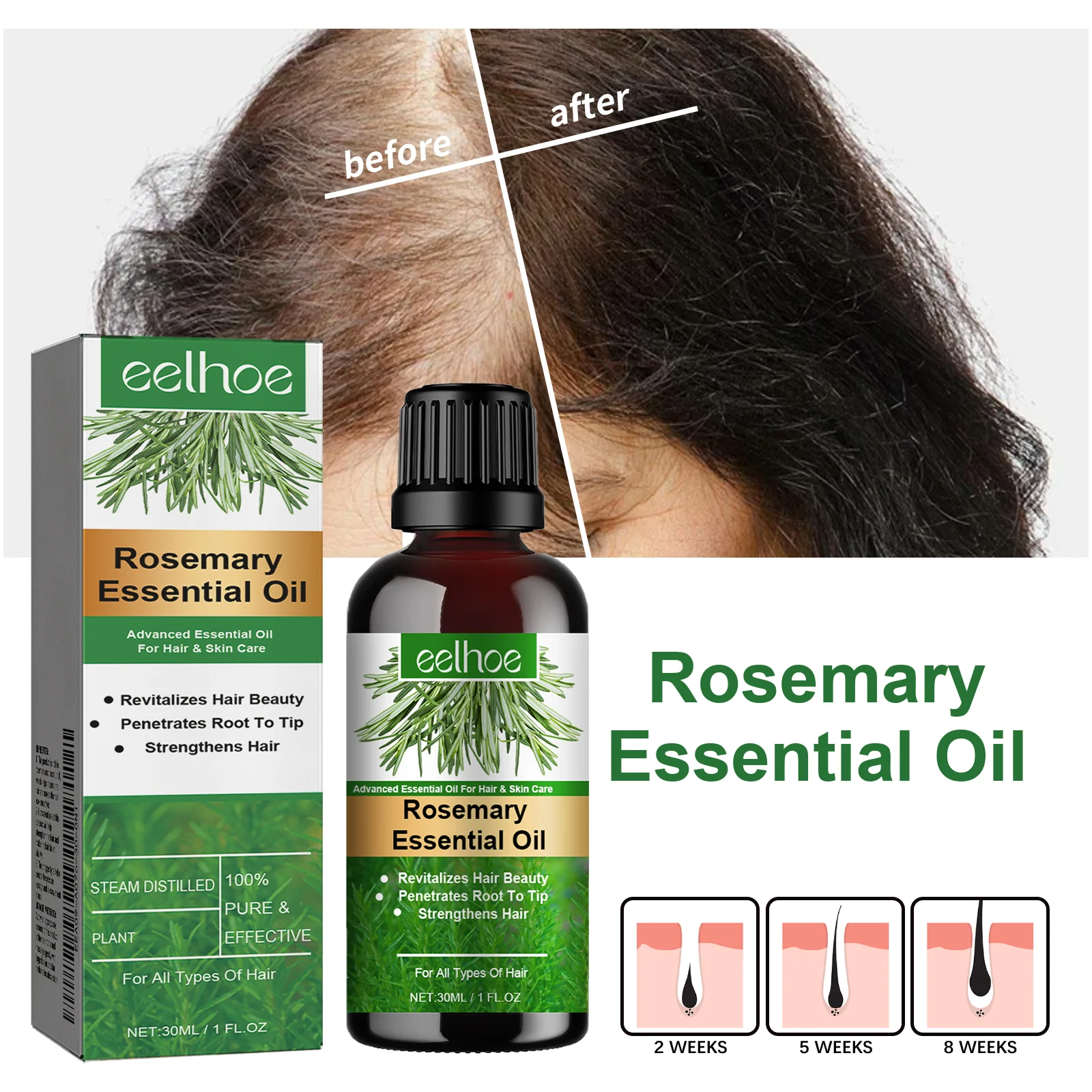 Rosemary Essential Oil Hair Growth Scalp Treatment Strengthens & Revitalizes Hair 30ml 2 rosemary essential oil hair growth scalp treatment 30ml cih r9db6kpa desc 2