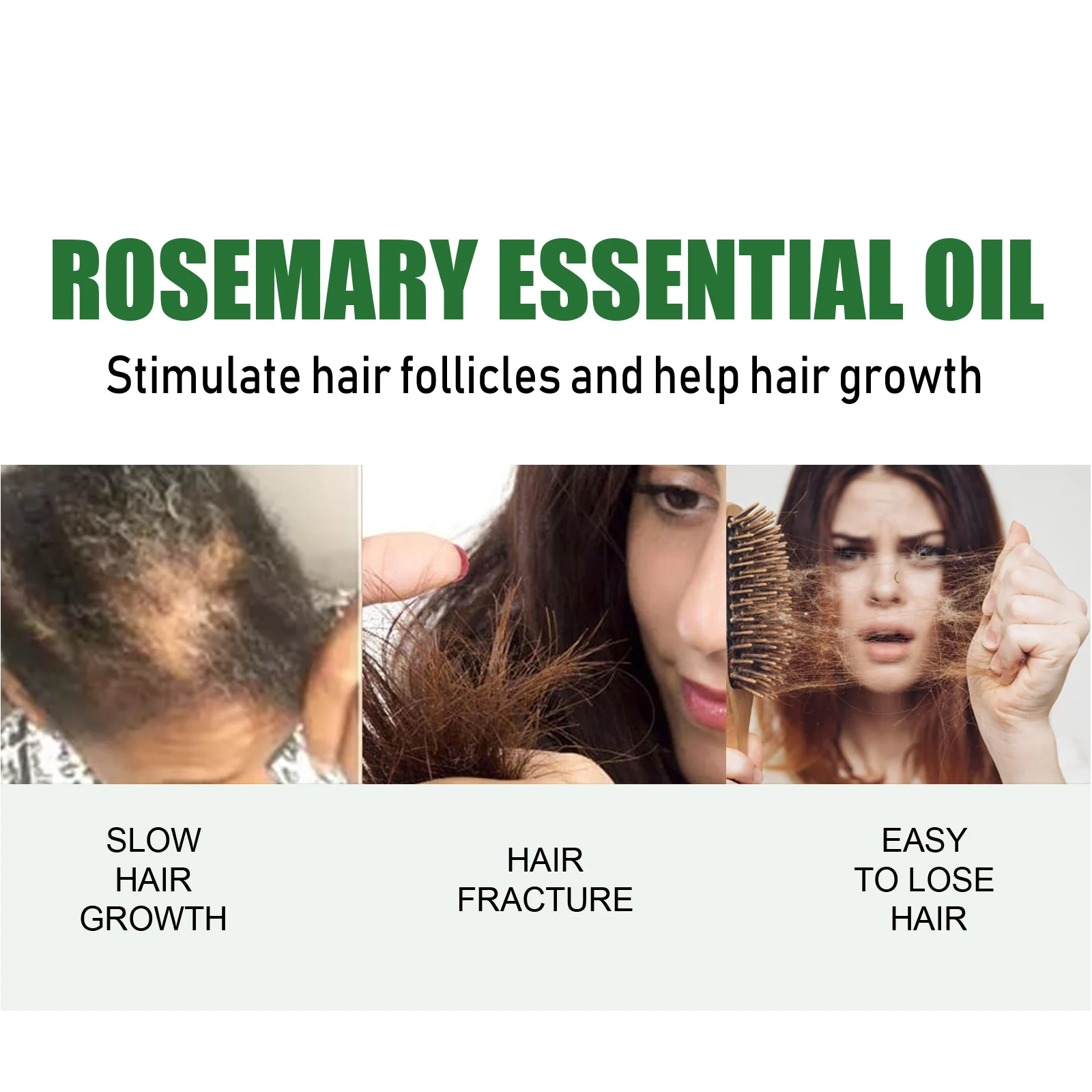 Rosemary Essential Oil Hair Growth Scalp Treatment Strengthens & Revitalizes Hair 30ml 5 rosemary essential oil hair growth scalp treatment 30ml cih r9db6kpa desc 5