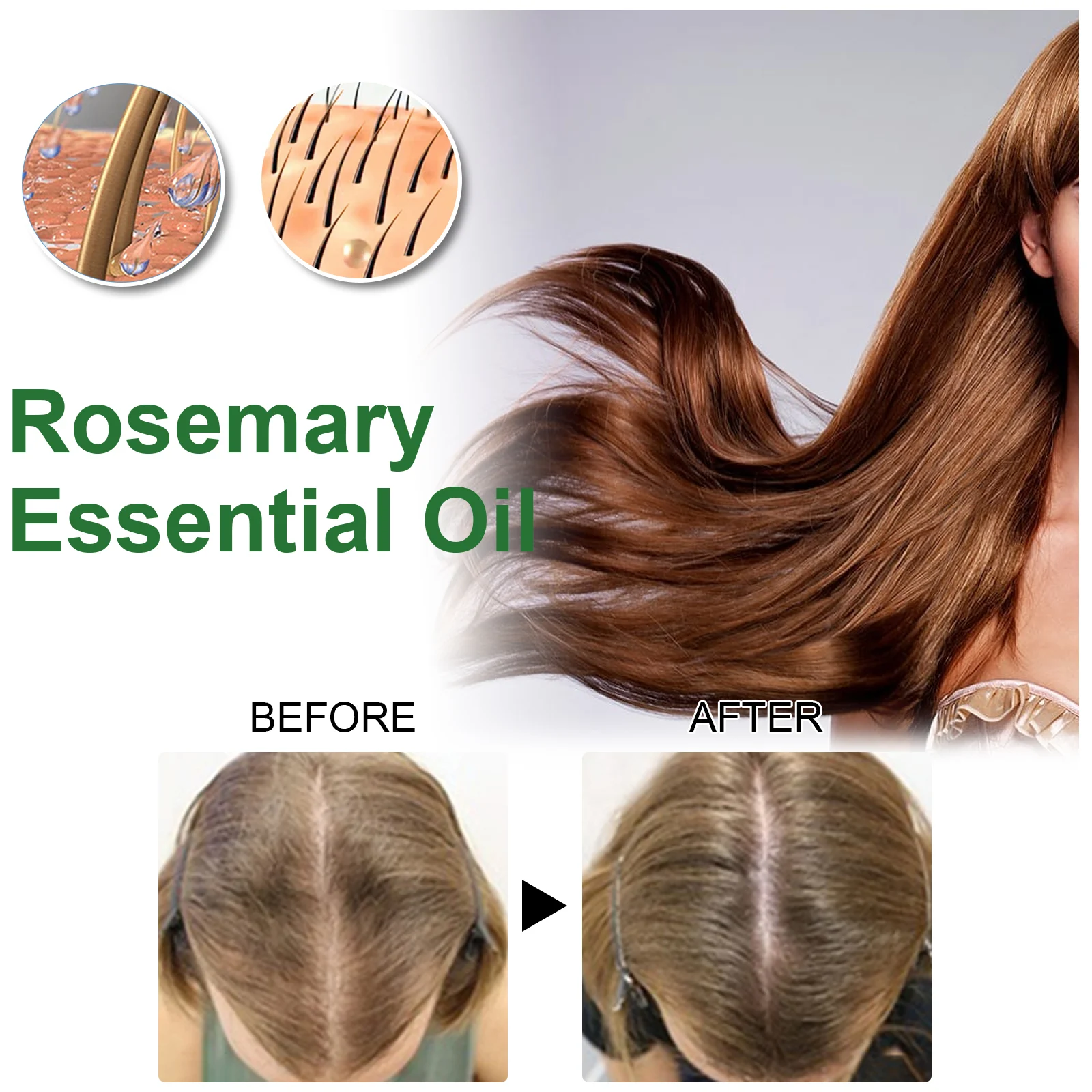 Rosemary Essential Oil Hair Growth Scalp Treatment Strengthens & Revitalizes Hair 30ml 6 rosemary essential oil hair growth scalp treatment 30ml cih r9db6kpa desc 6