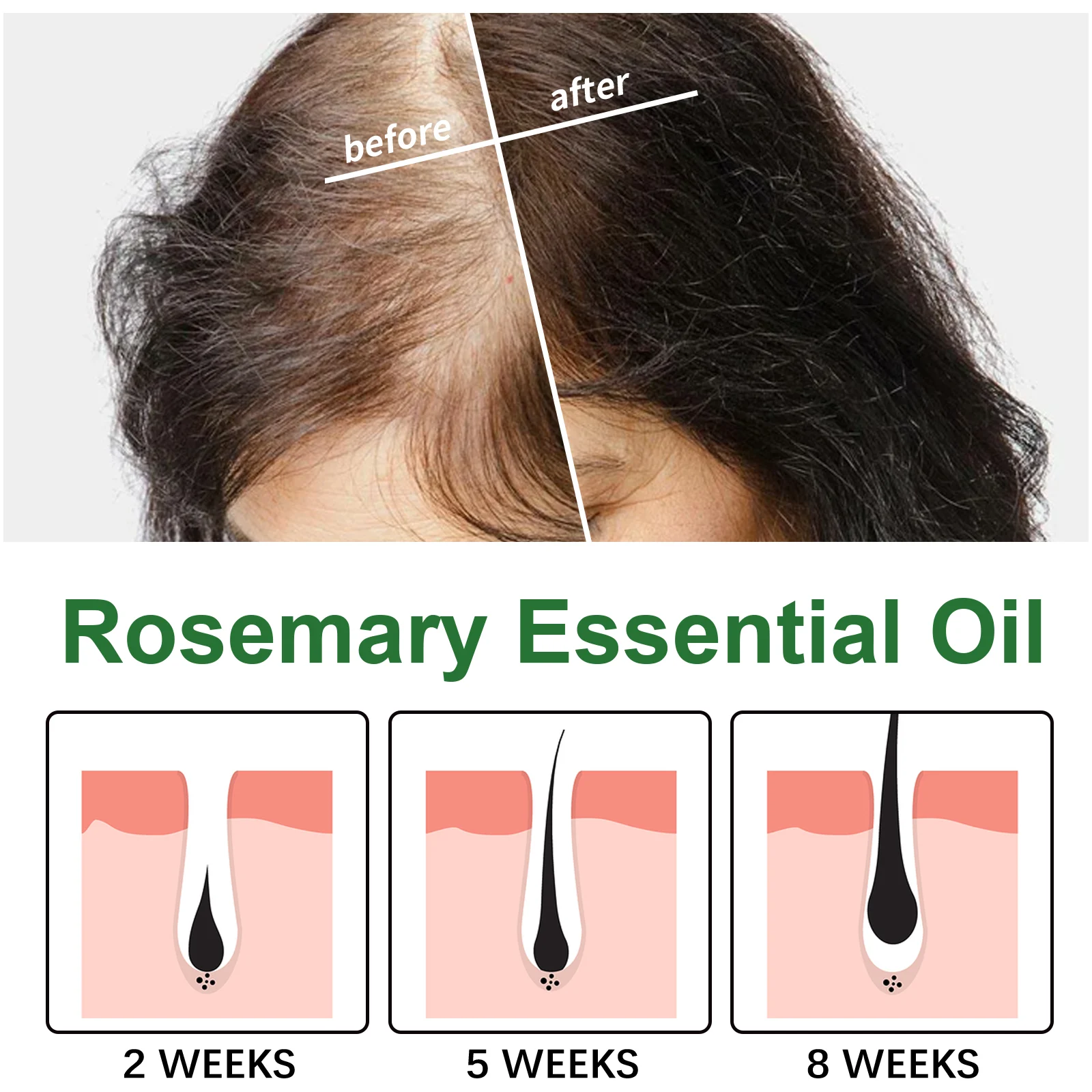 Rosemary Essential Oil Hair Growth Scalp Treatment Strengthens & Revitalizes Hair 30ml 7 rosemary essential oil hair growth scalp treatment 30ml cih r9db6kpa desc 7