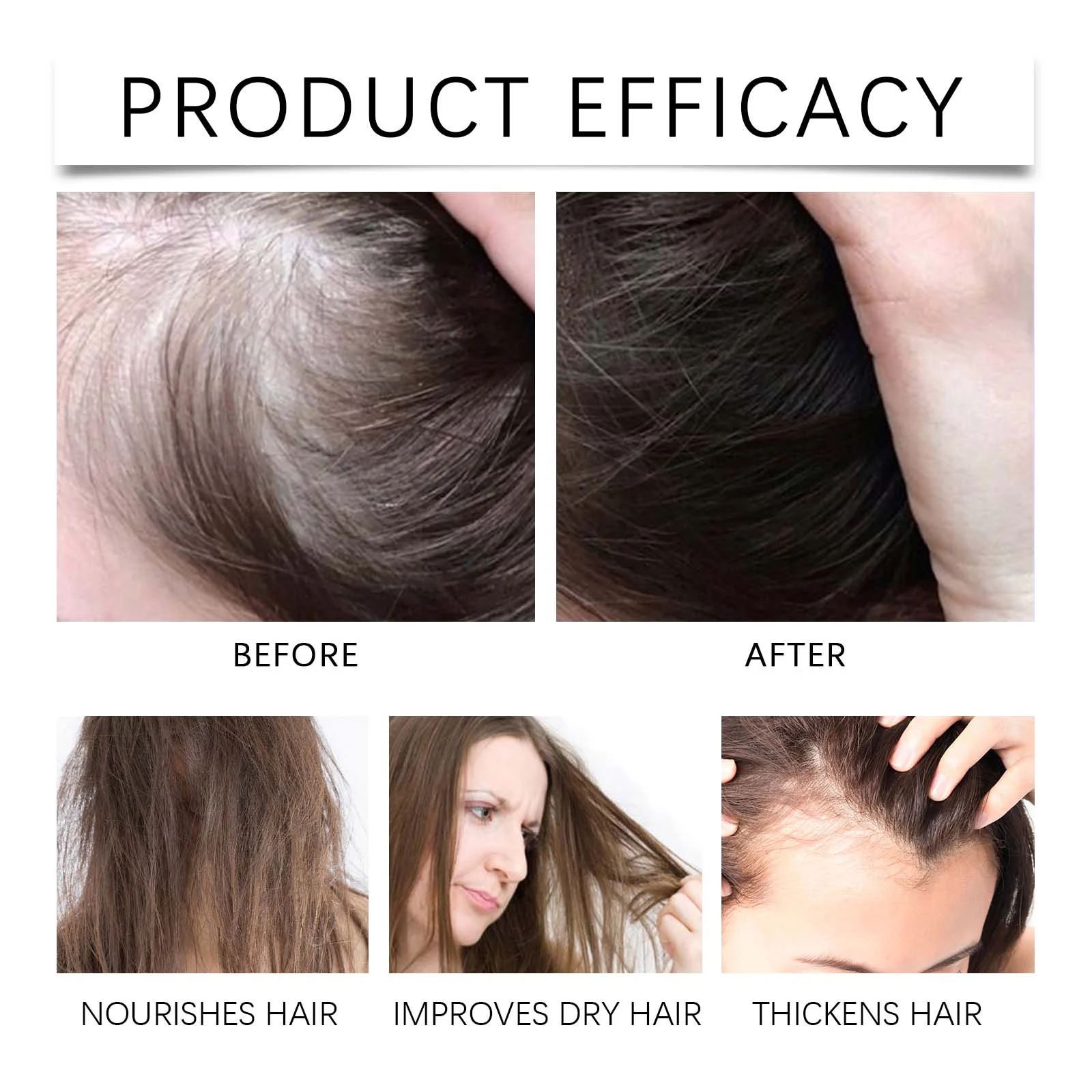 Rosemary Hair Growth Oil for Scalp Nourishment Anti-Hair Loss 60ml 9 rosemary hair growth oil scalp nourishment 60ml cih h6ykt69d desc 9