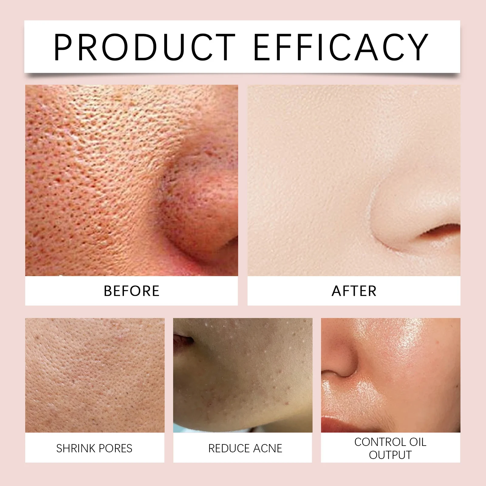 Hoygi Salicylic Acid Exfoliating Cleansing Gel with Peach Extract for Smooth Skin 10 salicylic acid exfoliating gel cih 434h2cqh desc 10
