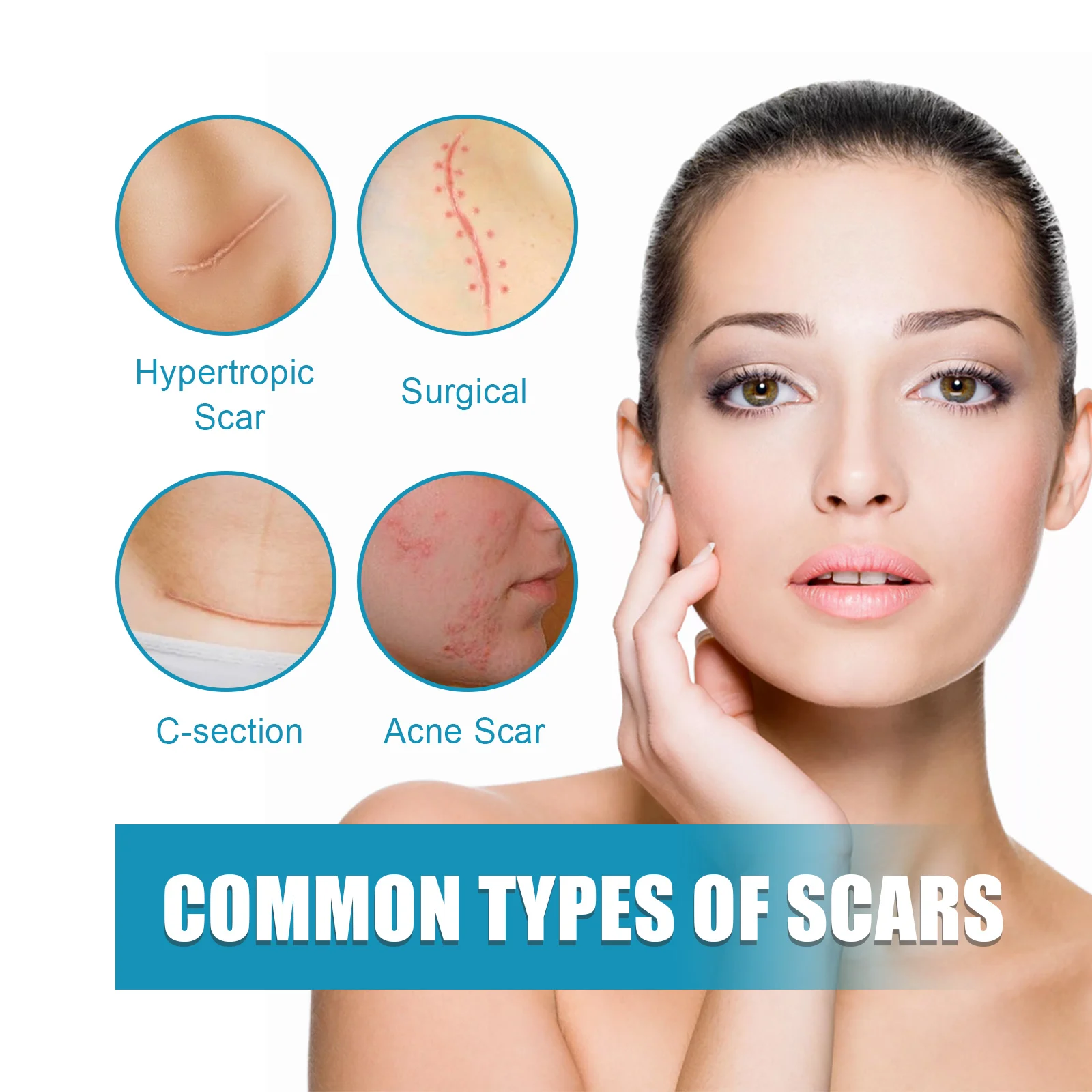 OUHOE Scar Repair Gel for Wounds, Sutures & Acne - Softens & Fades Scars, Improves Skin Tone 7 scar removal repair gel cih tp9v6a2w desc 7