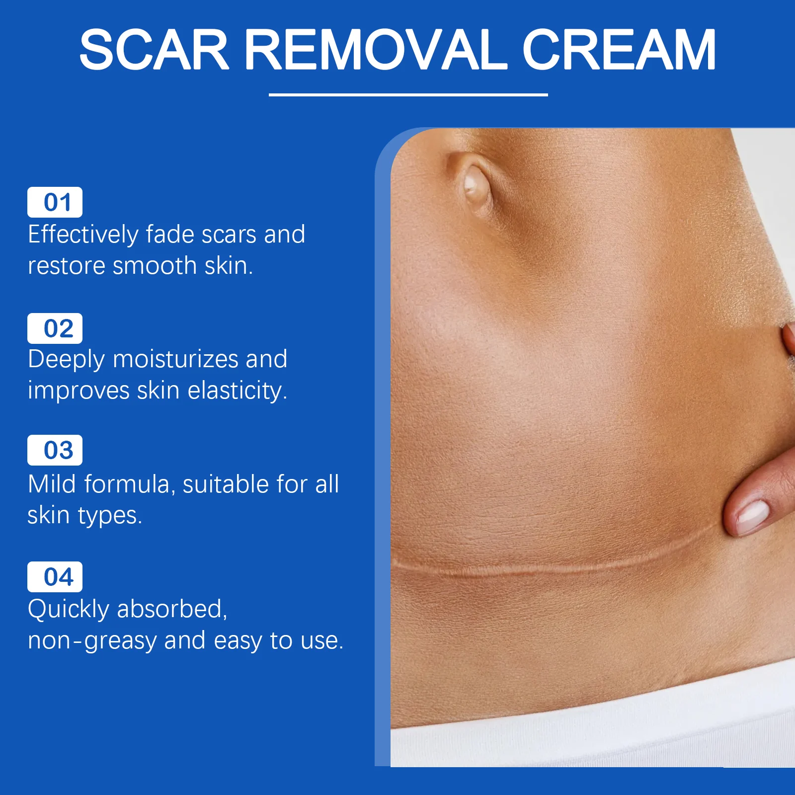 OceAura Skin Repair Cream for Scar Fading, Moisturizing & Stretch Mark Relief 5 scar repair cream cih b567q2ns desc 5