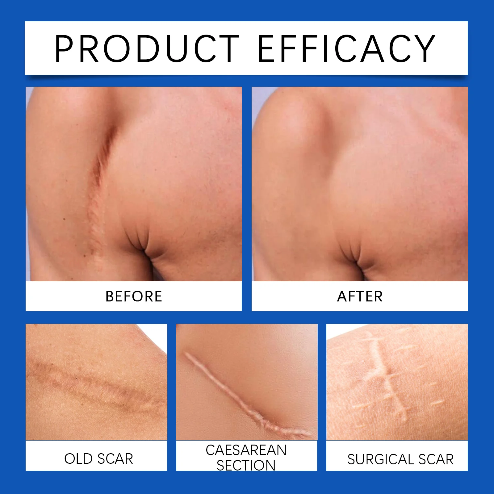 OceAura Skin Repair Cream for Scar Fading, Moisturizing & Stretch Mark Relief 9 scar repair cream cih b567q2ns desc 9