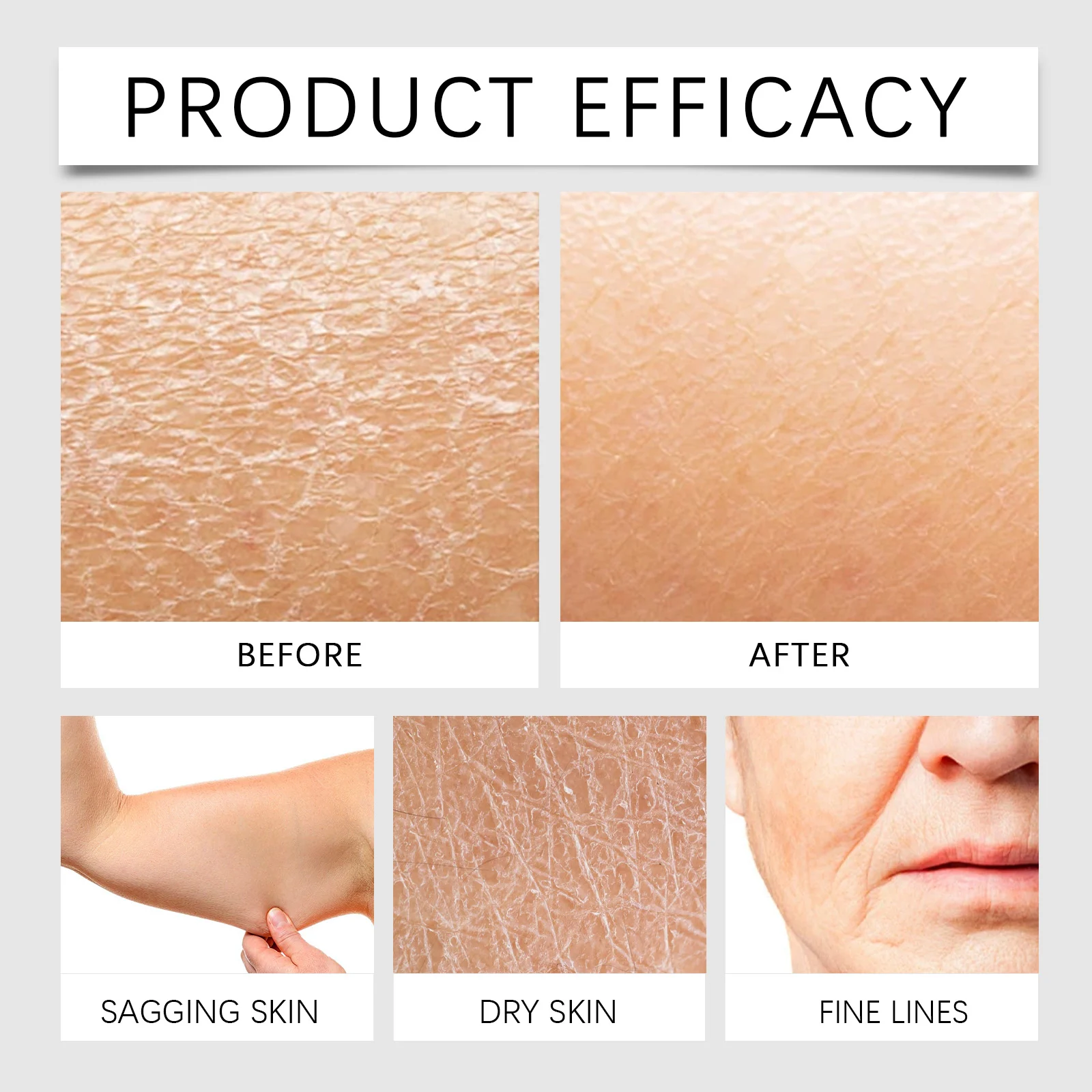 Hoygi Rapid Skin Bleaching Cream with Niacinamide & Vitamin C, Brightening & Moisturizing Body Cream 9 skin bleaching moisturizing cream cih 8beurhnp desc 9 1