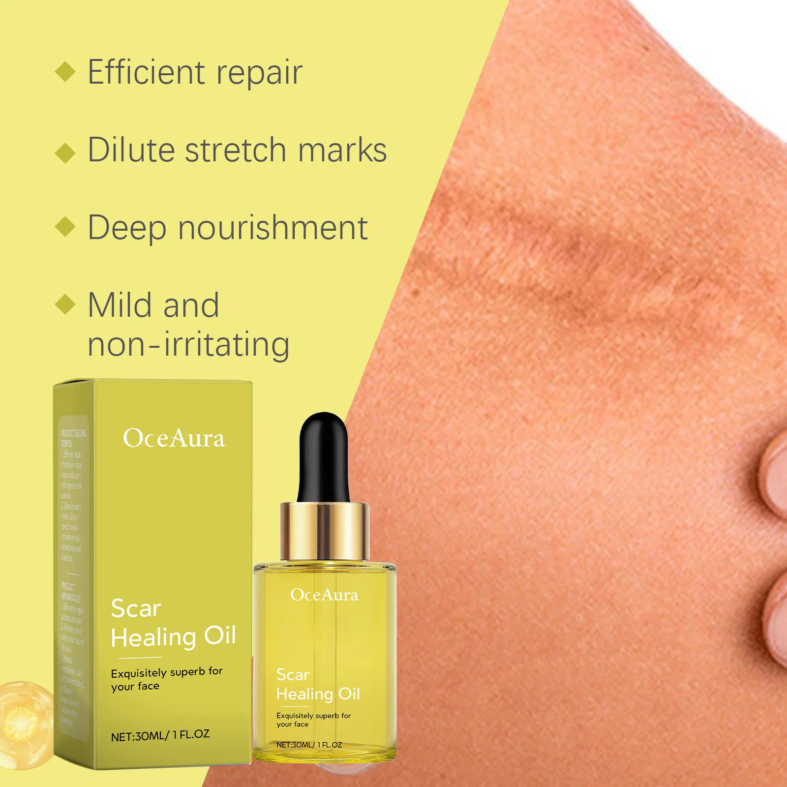 OceAura Skin Repair Healing Oil - Scar Fading & Moisturizing with Vitamin E & Hyaluronic Acid 7 skin scar healing repair oil cih e59pbr7e desc 7