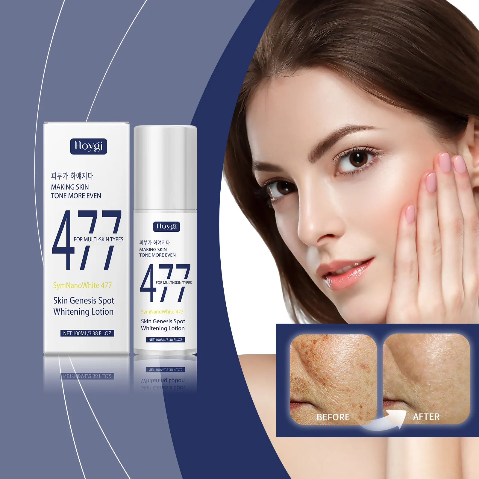 Spot Whitening Lotion 100ml Moisturizing Brightening Cream for Even Skin Tone and Hydration 2 spot whitening lotion 100ml moisturizing brightening cream cih bawuq5ma desc 2