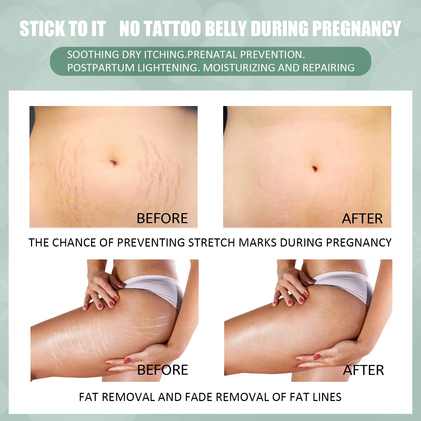 Stretch Mark Repair Cream for Pregnancy 50g - Soothes, Firms & Moisturizes 4 stretch mark repair cream pregnancy 50g cih ws8sd9jq desc 4