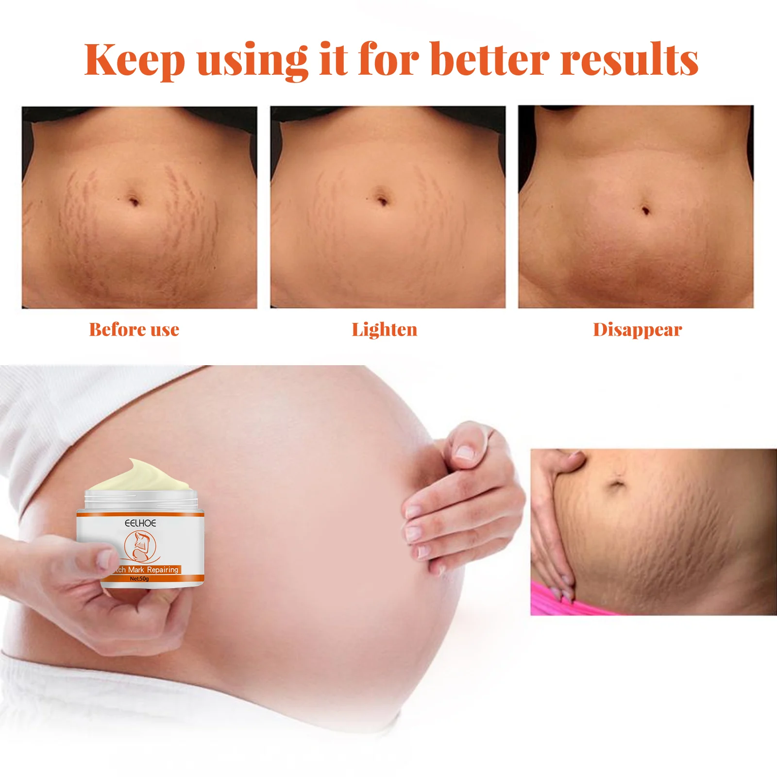 Stretch Mark Repairing Cream 50g - Intensive Moisturizing & Skin Elasticity Enhancer 7 stretch mark repairing cream 50g cih b54mcsb5 desc 7