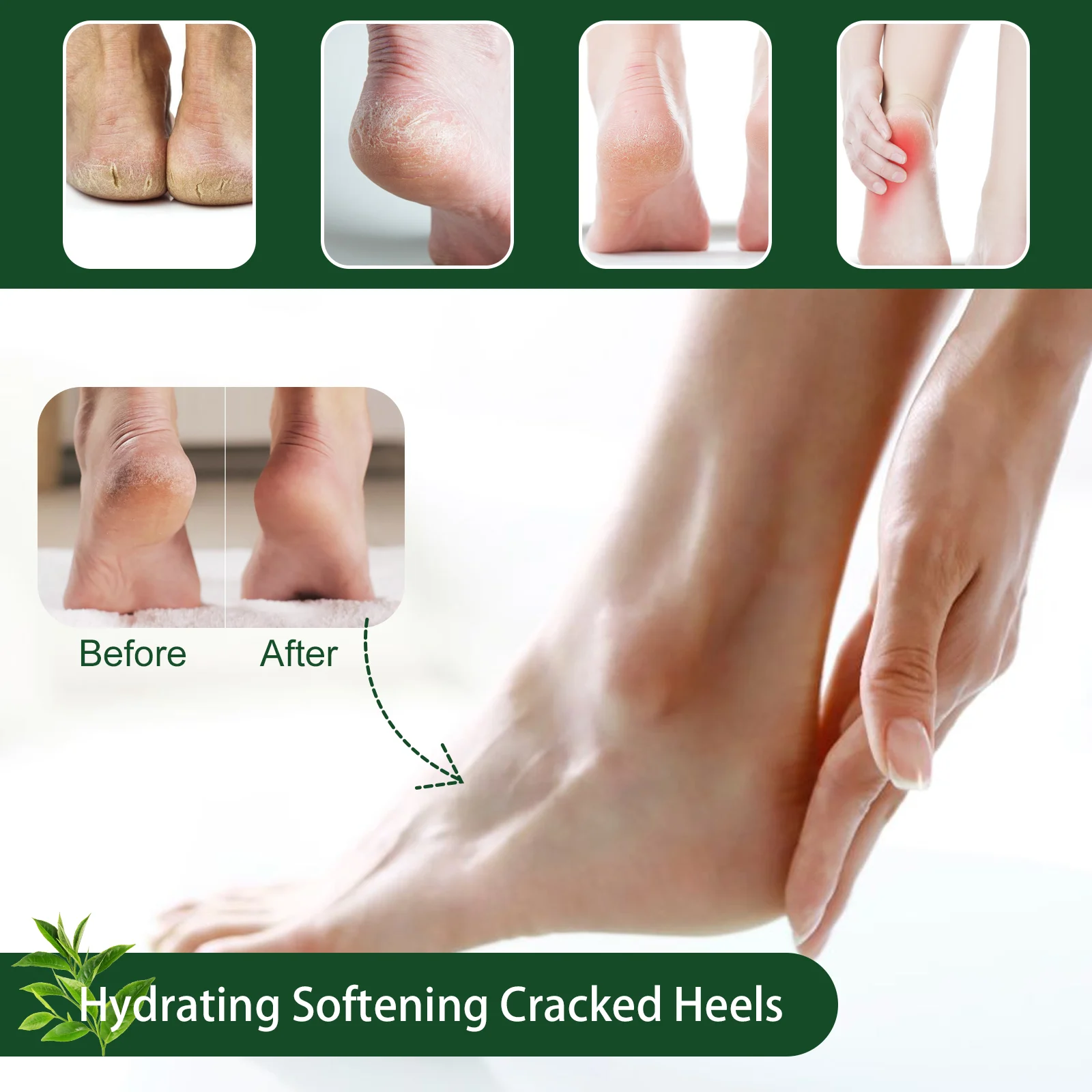 Tea Tree Oil Foot Cream for Cracked Heels, Hydrating & Repairing Foot Care 50ml 6 tea tree oil foot cream cracked heels hydrating cih 3tqd99zu desc 6