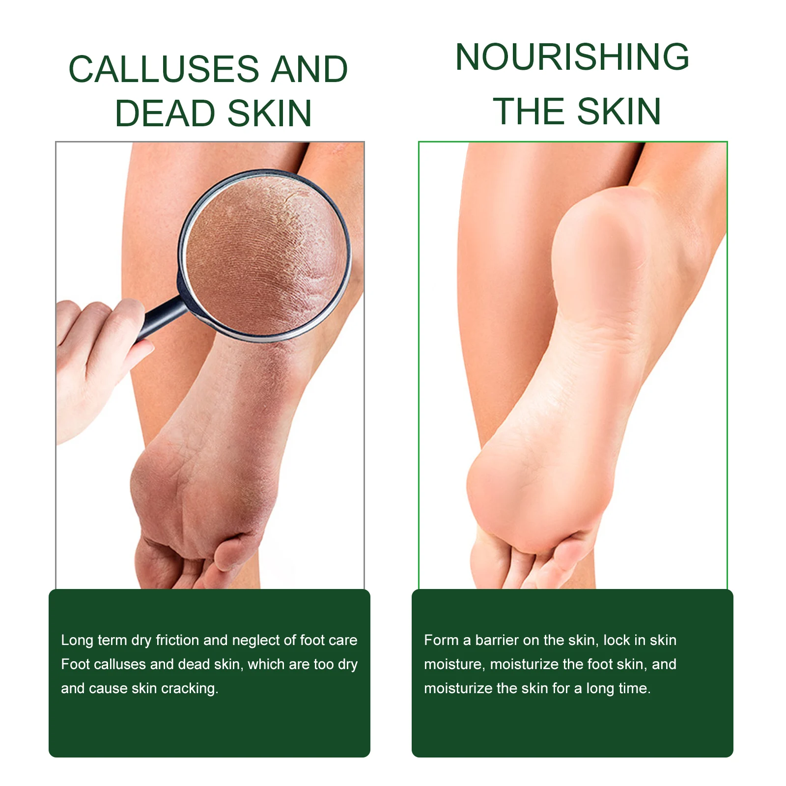 Tea Tree Oil Foot Cream for Cracked Heels, Hydrating & Repairing Foot Care 50ml 8 tea tree oil foot cream cracked heels hydrating cih 3tqd99zu desc 8