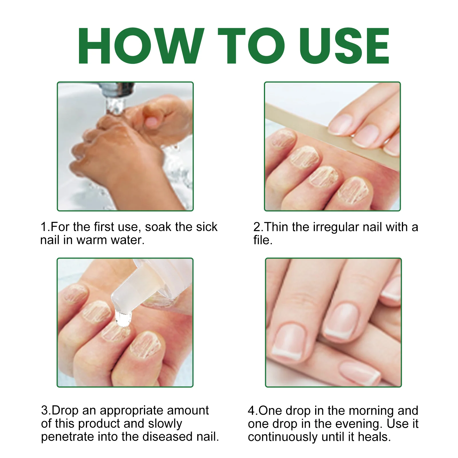 Toenail Fungus Repair Solution for Thickened, Discolored, and Peeling Nails 4 toenail fungus repair solution 20ml cih 9gwzqqy5 desc 4