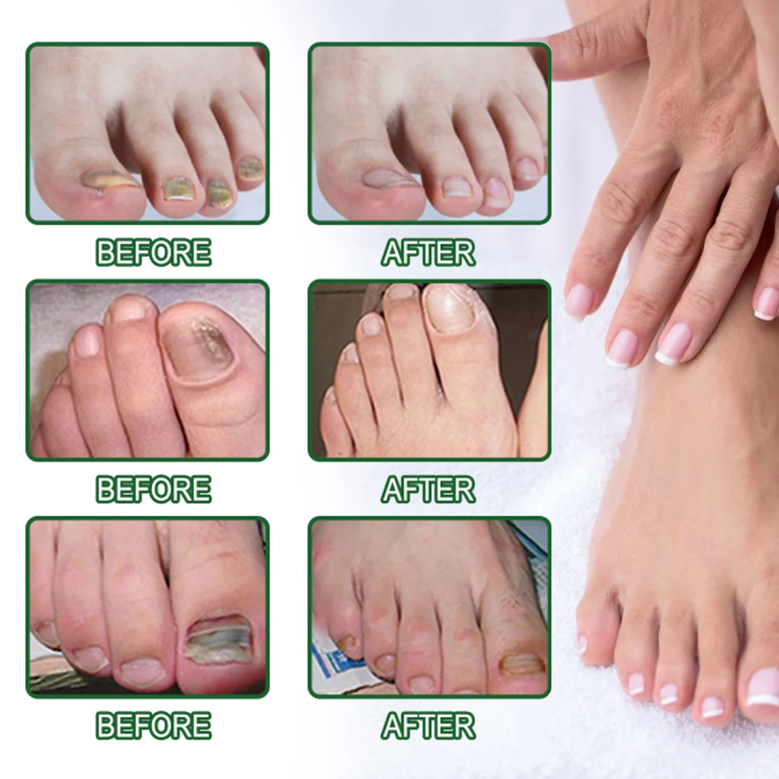 Toenail Fungus Repair Solution for Thickened, Discolored, and Peeling Nails 9 toenail fungus repair solution 20ml cih 9gwzqqy5 desc 9