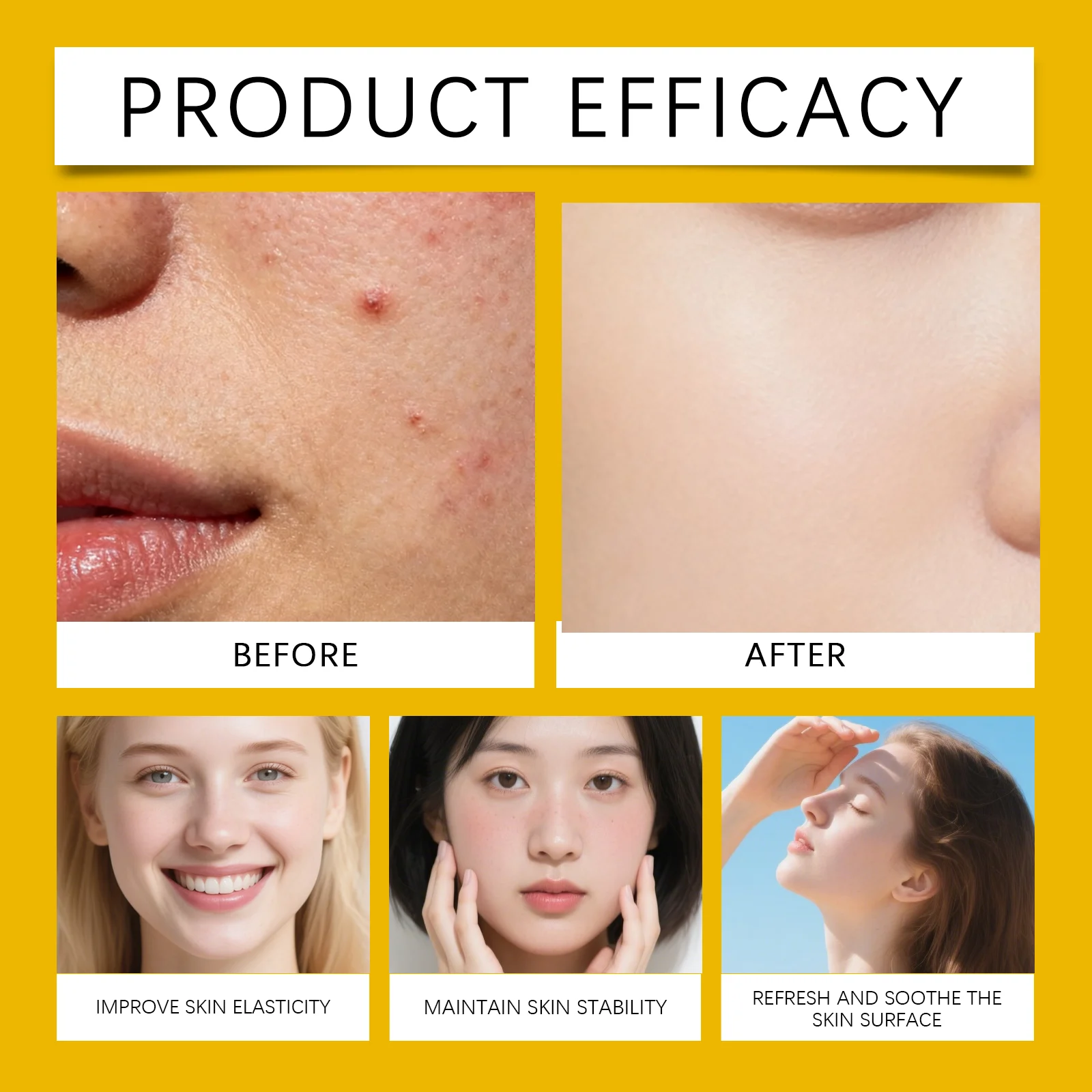 Acne Patches Transparent Hydrocolloid Cute Bear Shape Spot Treatment for Pimples & Blemish Care 11 transparent hydrocolloid acne patches bear shape der st2v8scj desc 11