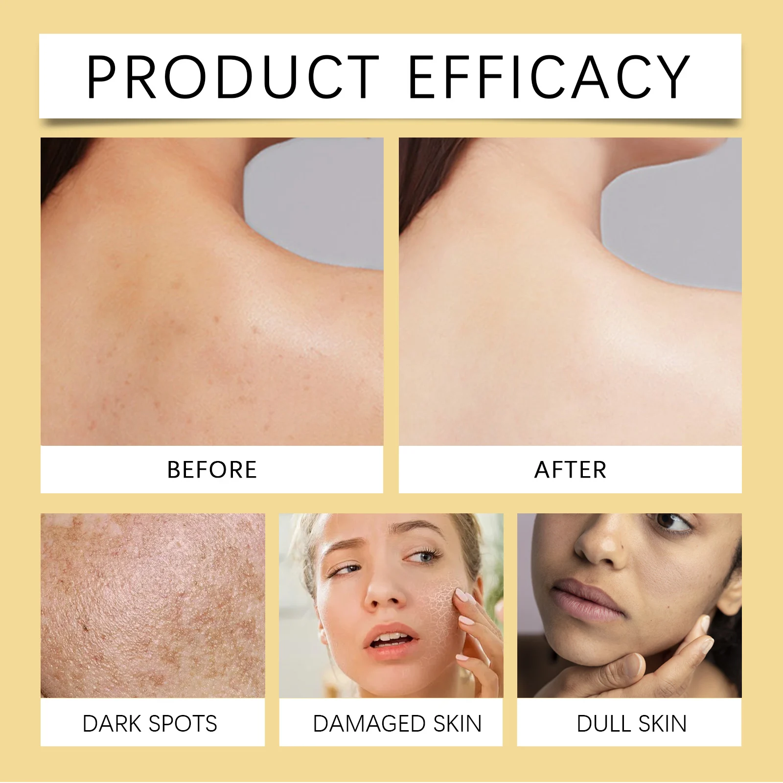 Turmeric Body Oil for Brightening 100ml with Collagen & Argan Oil - Skin Tone Corrector 9 turmeric body oil brightening 100ml collagen argan oil cih 2ts3sd7d desc 9