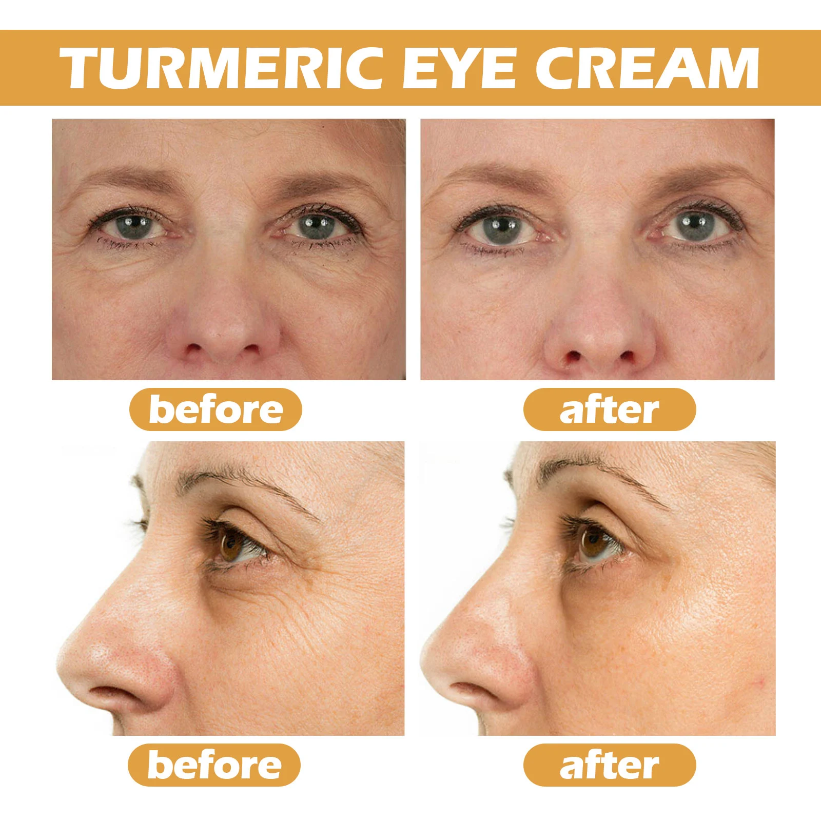 Turmeric Eye Cream 15ml for Dark Circles, Wrinkles & Puffiness - Brightening & Hydrating Under Eye Treatment 8 turmeric eye cream 15ml dark circles wrinkles puffiness cih 2t32syju desc 8