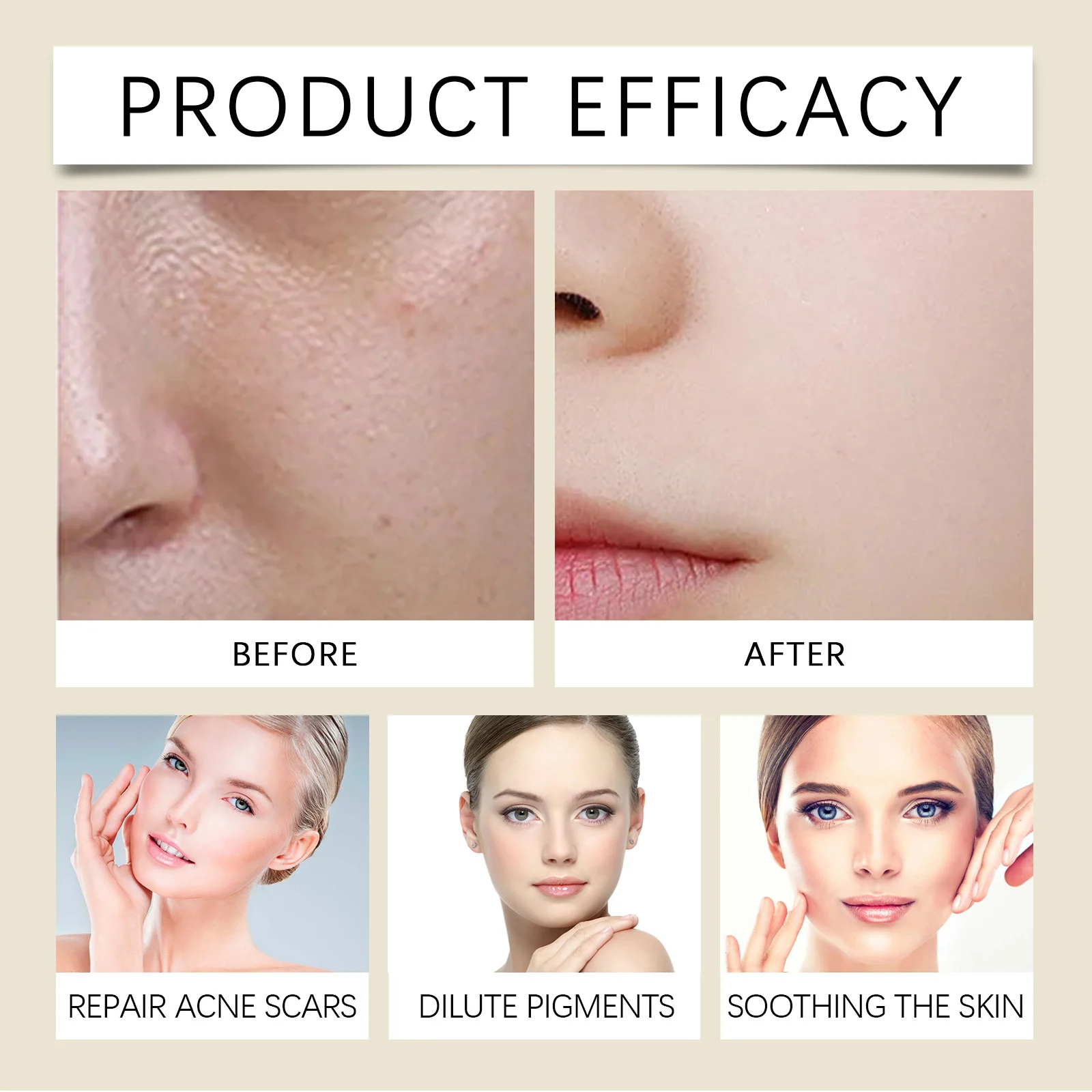 Houttuynia Cordata Hydrating Soothing Toner 100ml for Face, Sensitive Skin 12 viareline houttuynia cordata hydrating soothing toner 100ml cih tg5qf32b desc 12