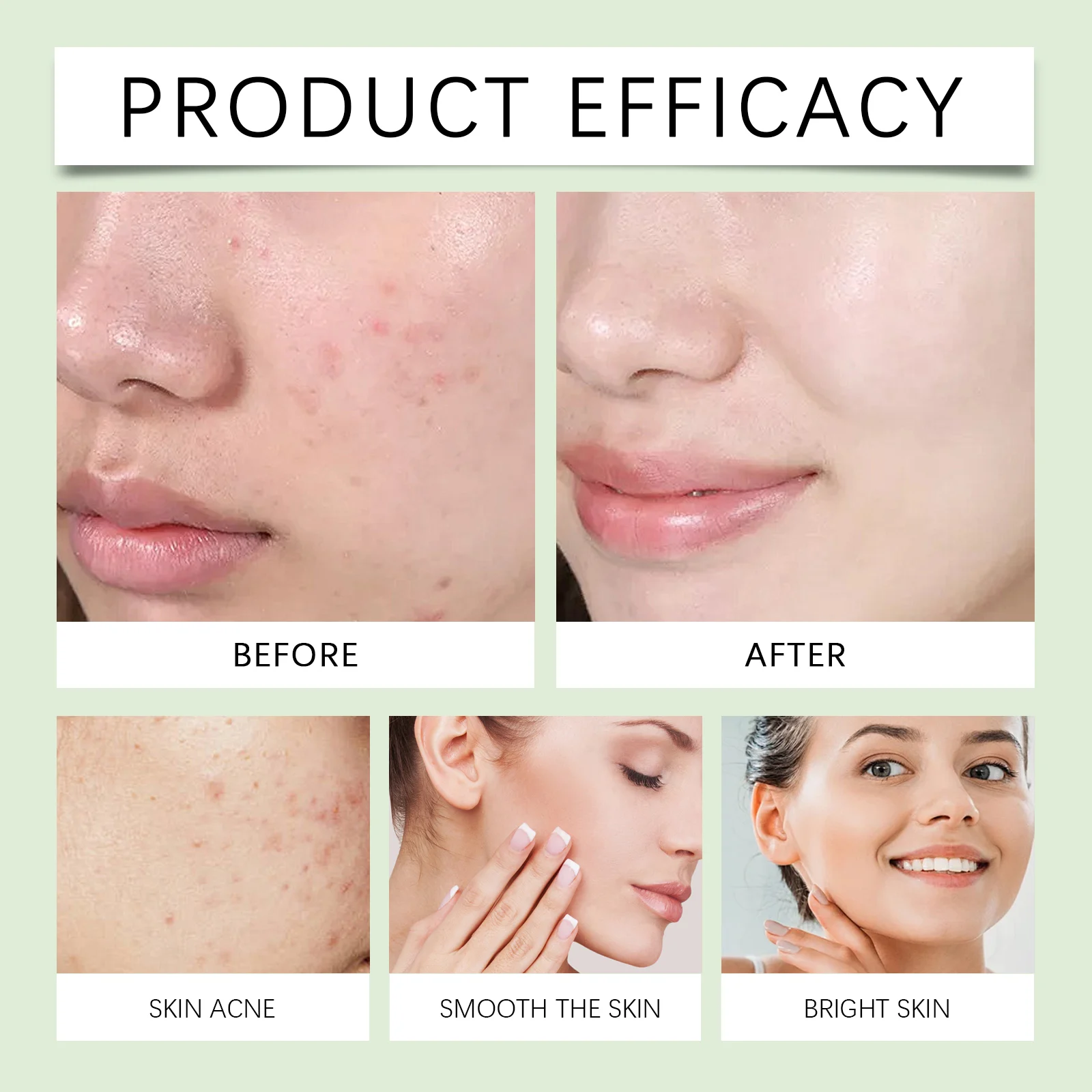 Salicylic Acid Serum with Tea Tree Oil - 30ml Anti-Acne Treatment for Clear, Smooth Skin 12 viareline salicylic acid serum 30ml cih fwup78ac desc 12
