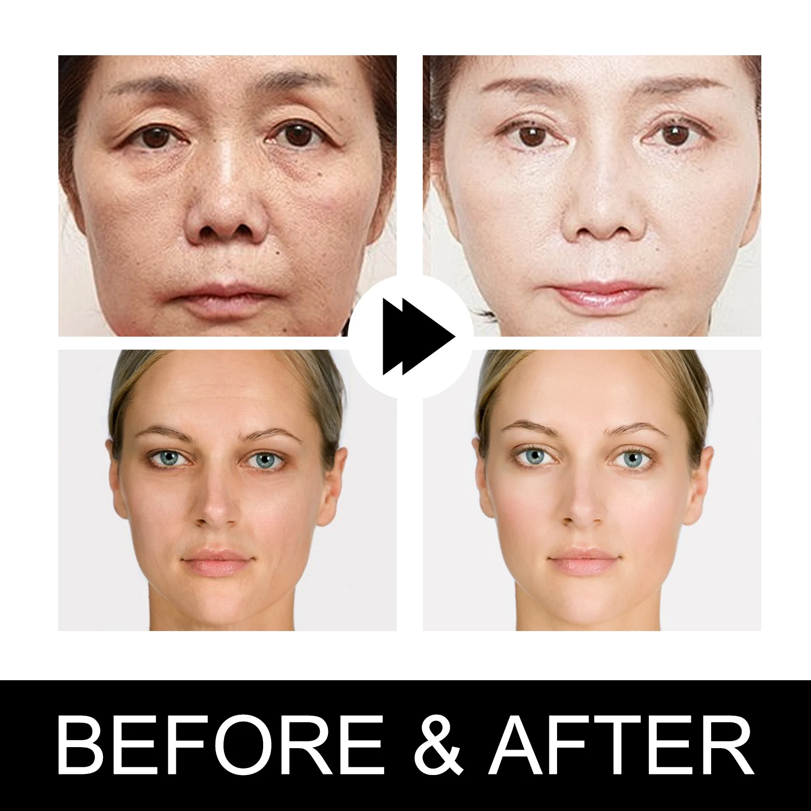 Hoygi Vitamin C Serum for Anti-Aging, Hydration & Brightening 9 vitamin c serum cih 6zetd52w desc 9