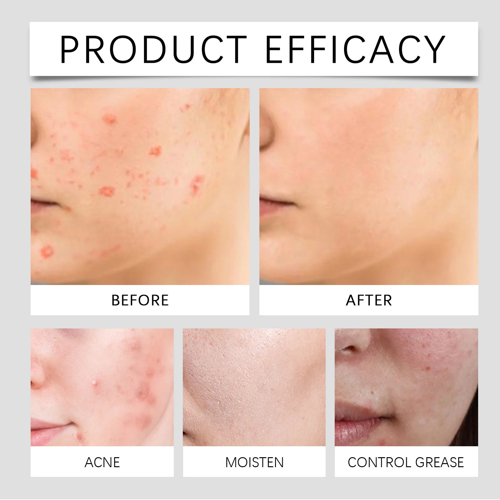 Wart Removal Patches Gentle Smoothing Skin Care Treatment for All Skin Types 12 wart removal patches gentle skin care treatment der bejj35hv desc 12