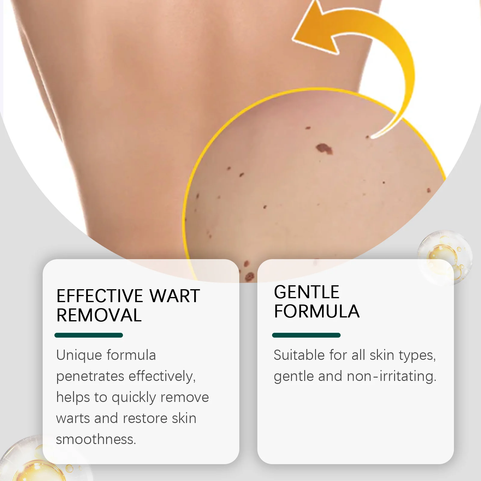 Wart Removal Patches Gentle Smoothing Skin Care Treatment for All Skin Types 9 wart removal patches gentle skin care treatment der bejj35hv desc 9