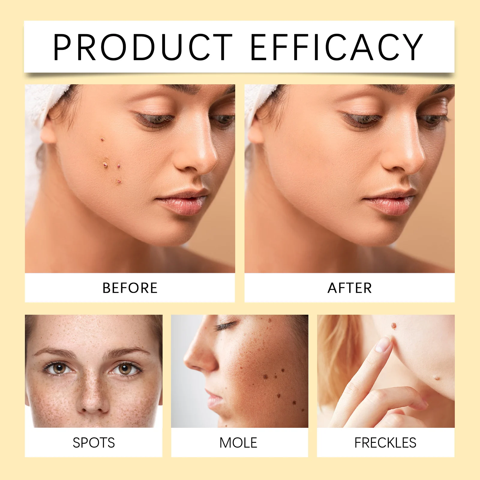 Wart Removal Serum Anti-Freckle Spot Treatment with Hyaluronic Acid & Glycerin 30ml 9 wart removal serum anti freckle spot treatment 30ml cih dhd5zmjx desc 9