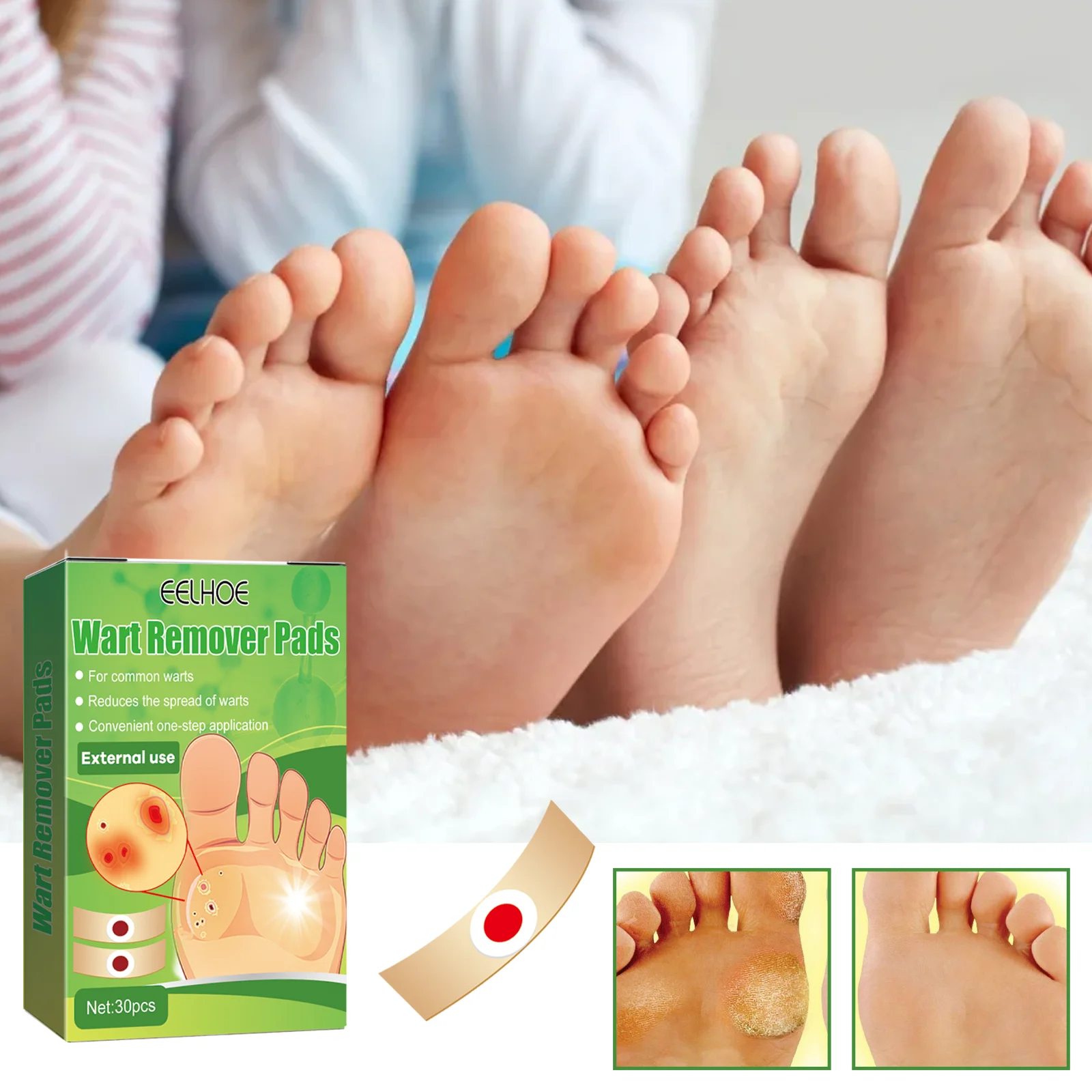 Wart Remover Pads for Common & Flat Warts, Corns, Calluses - 30 Pads, 7x2cm 2 wart remover pads 30pcs 7x2cm cih 73rdc3hu desc 2