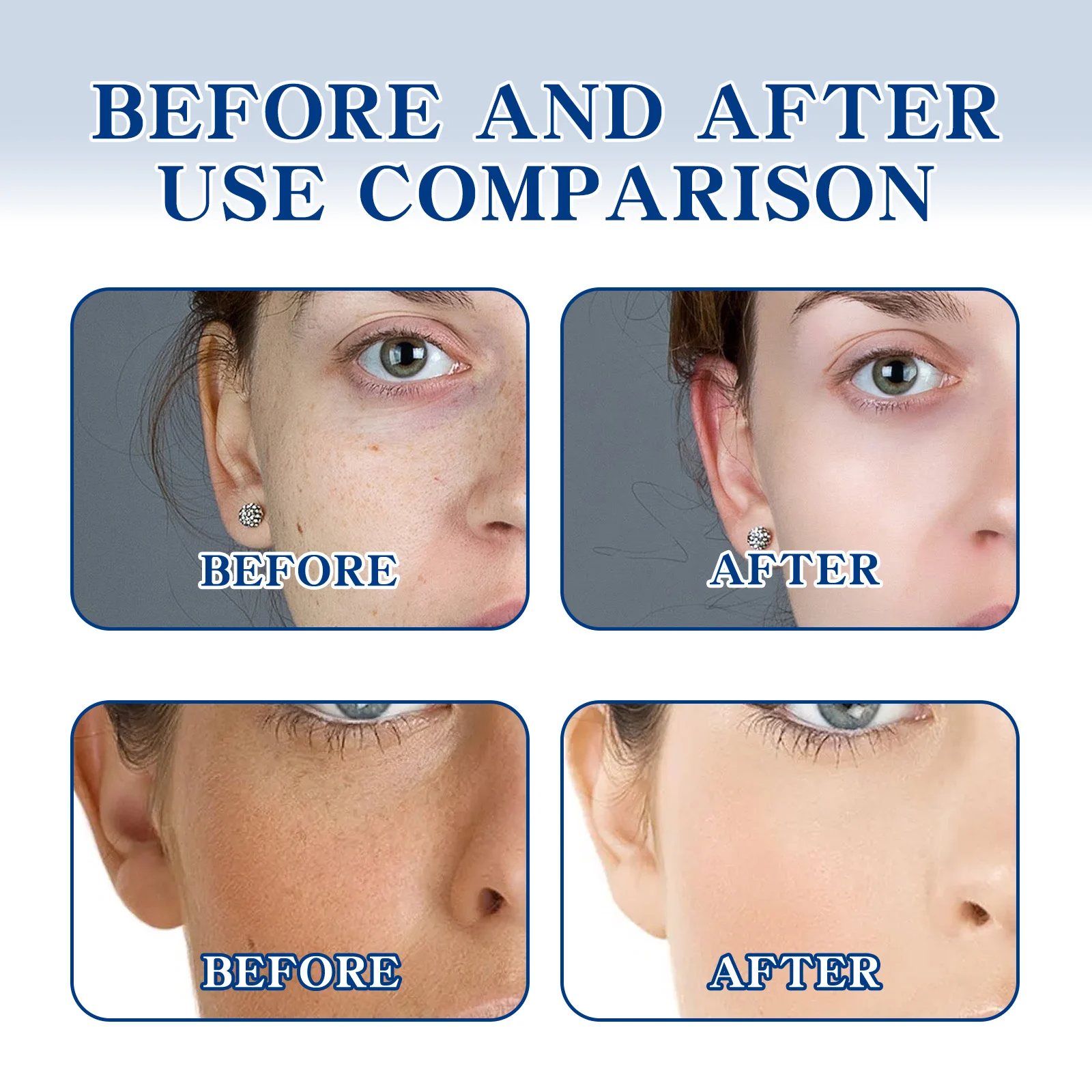 OUHOE Whitening Freckle Essence Cream - Brighten Skin Tone, Reduce Dark Spots, Moisturize 8 whitening freckle essence cream cih 8efvq9sx desc 8