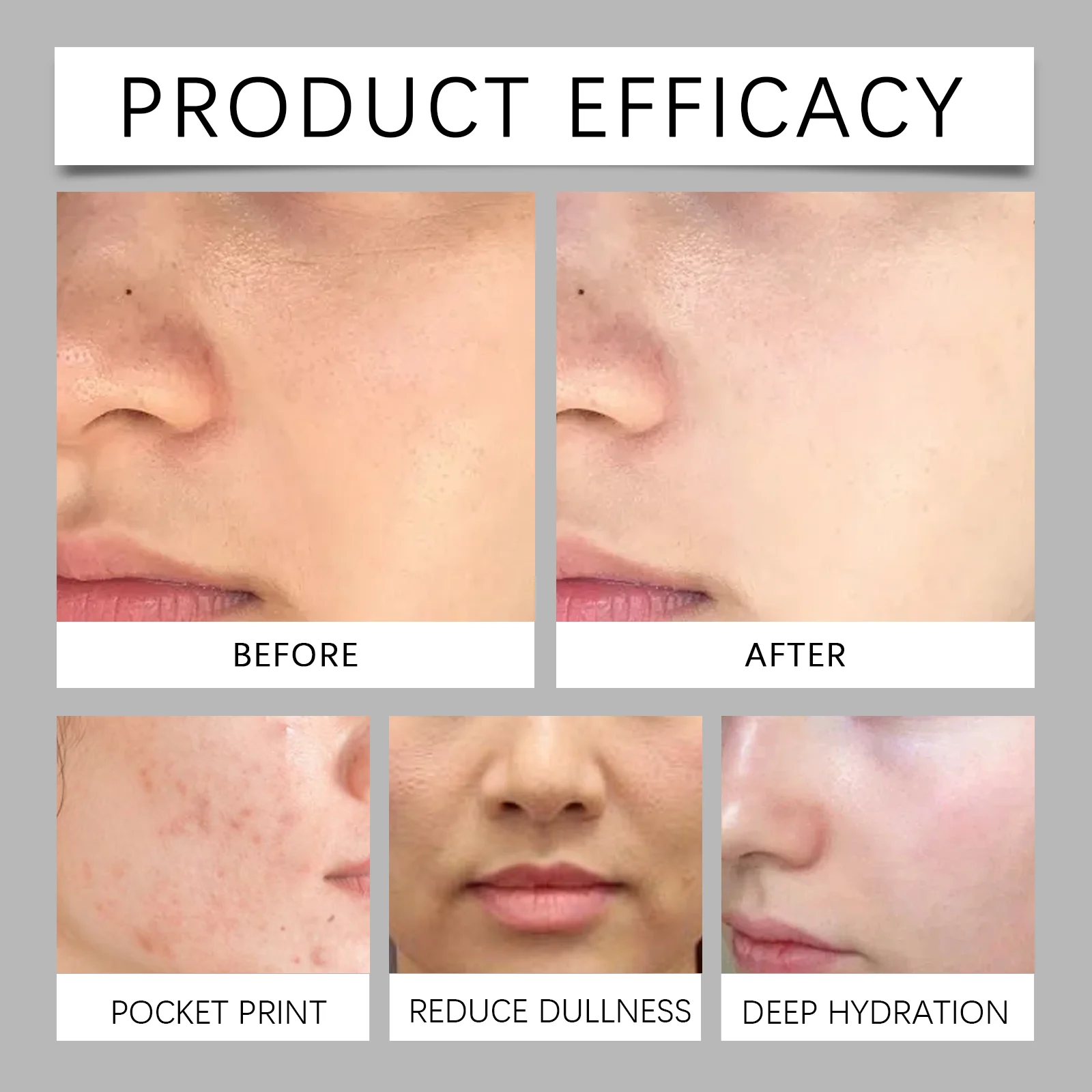 Witch Hazel Hydrating Toner Facial Moisturizer 100ml for Daily Skincare 12 witch hazel hydrating facial toner 100ml cih s55pkkzj desc 12